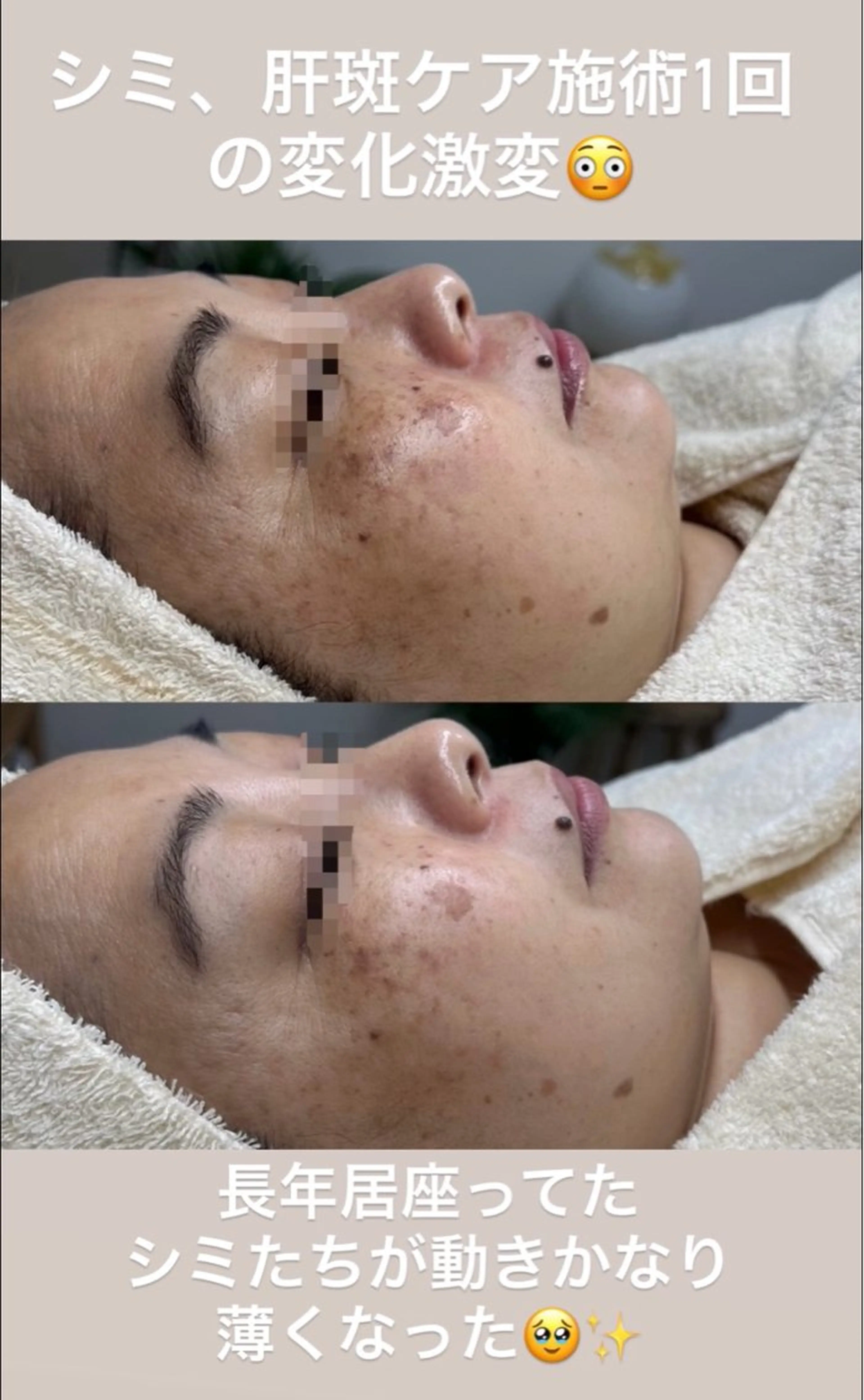 HINA/産毛脱毛・ 肌質改善専門サロンのエステ・リラクイメージ