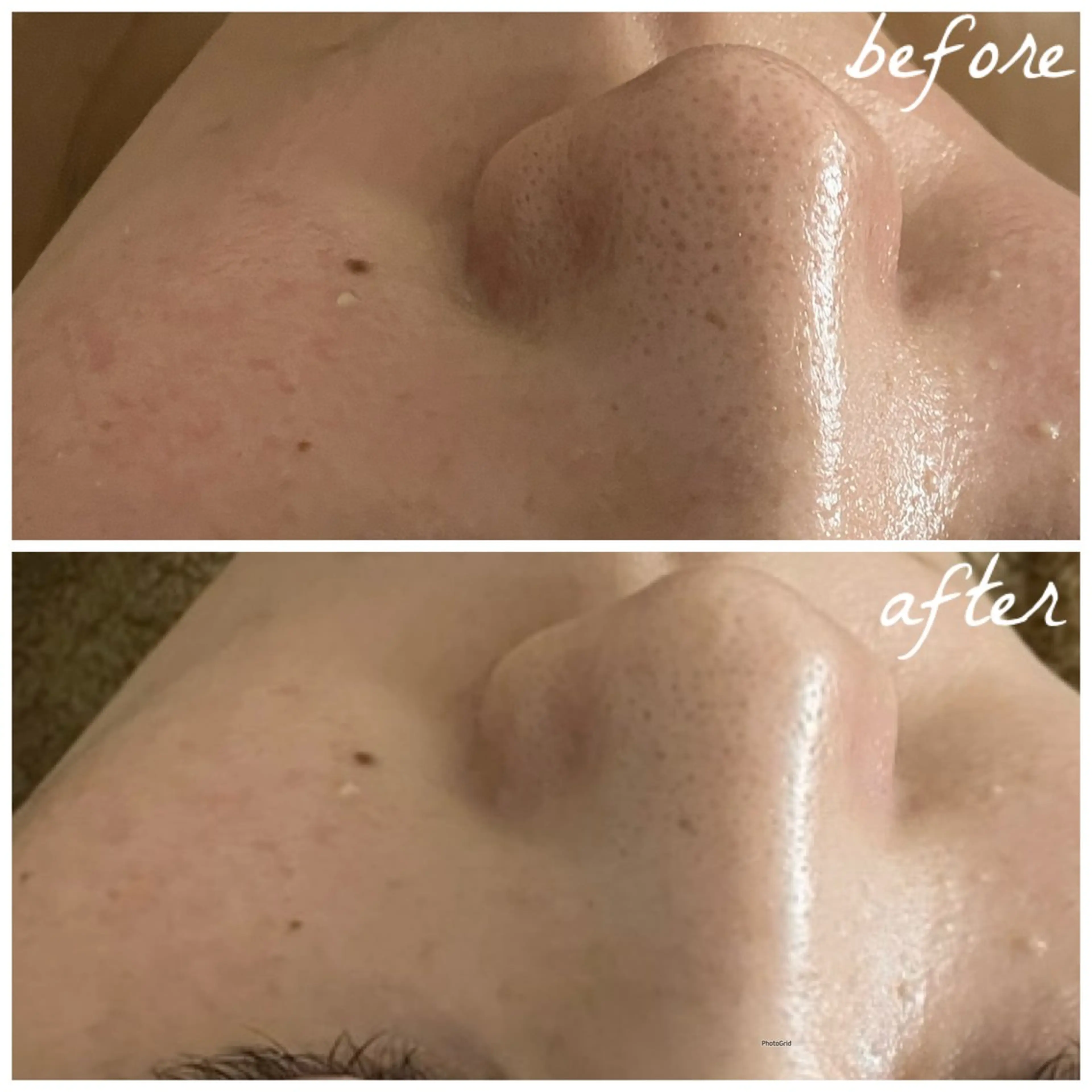 メンズ エステ メナード岐阜茜部 杉浦のエステ・リラクイメージ