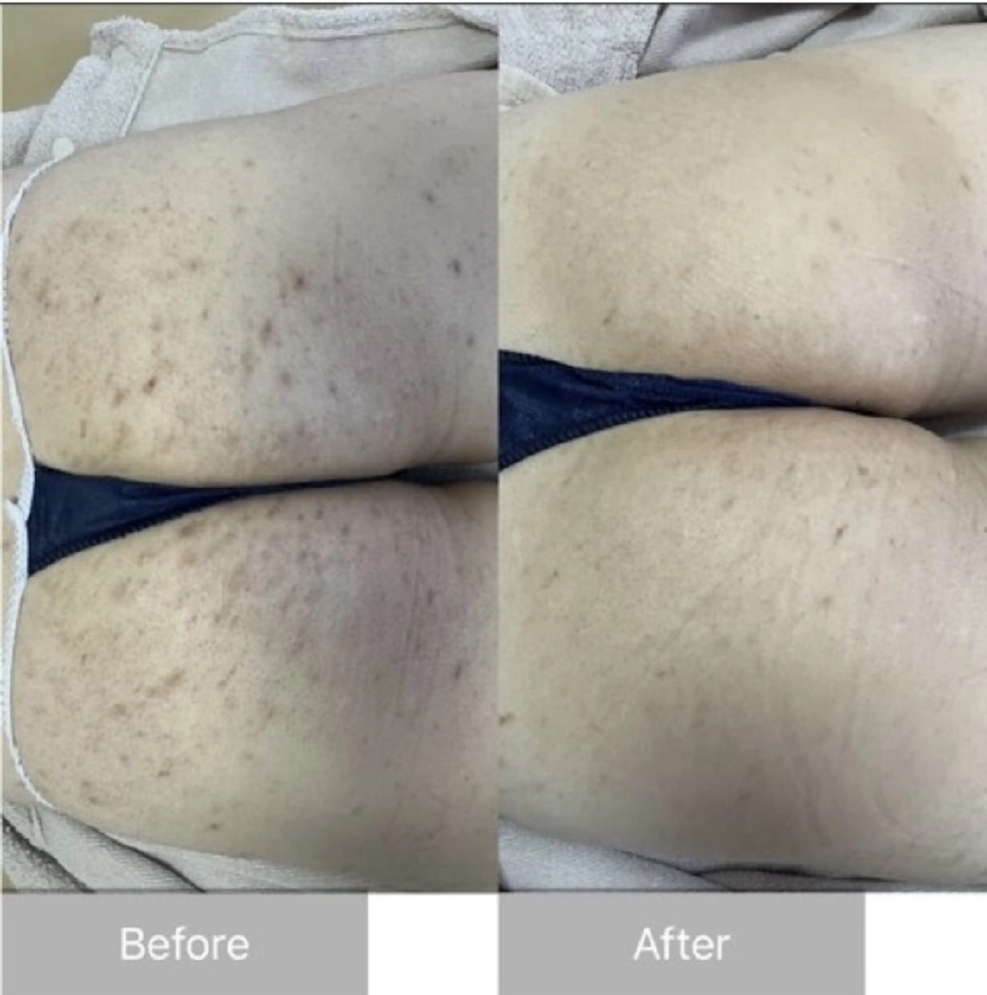 エステ ハーブピーリング専門 COCO.梅田中津のエステ・リラクイメージ