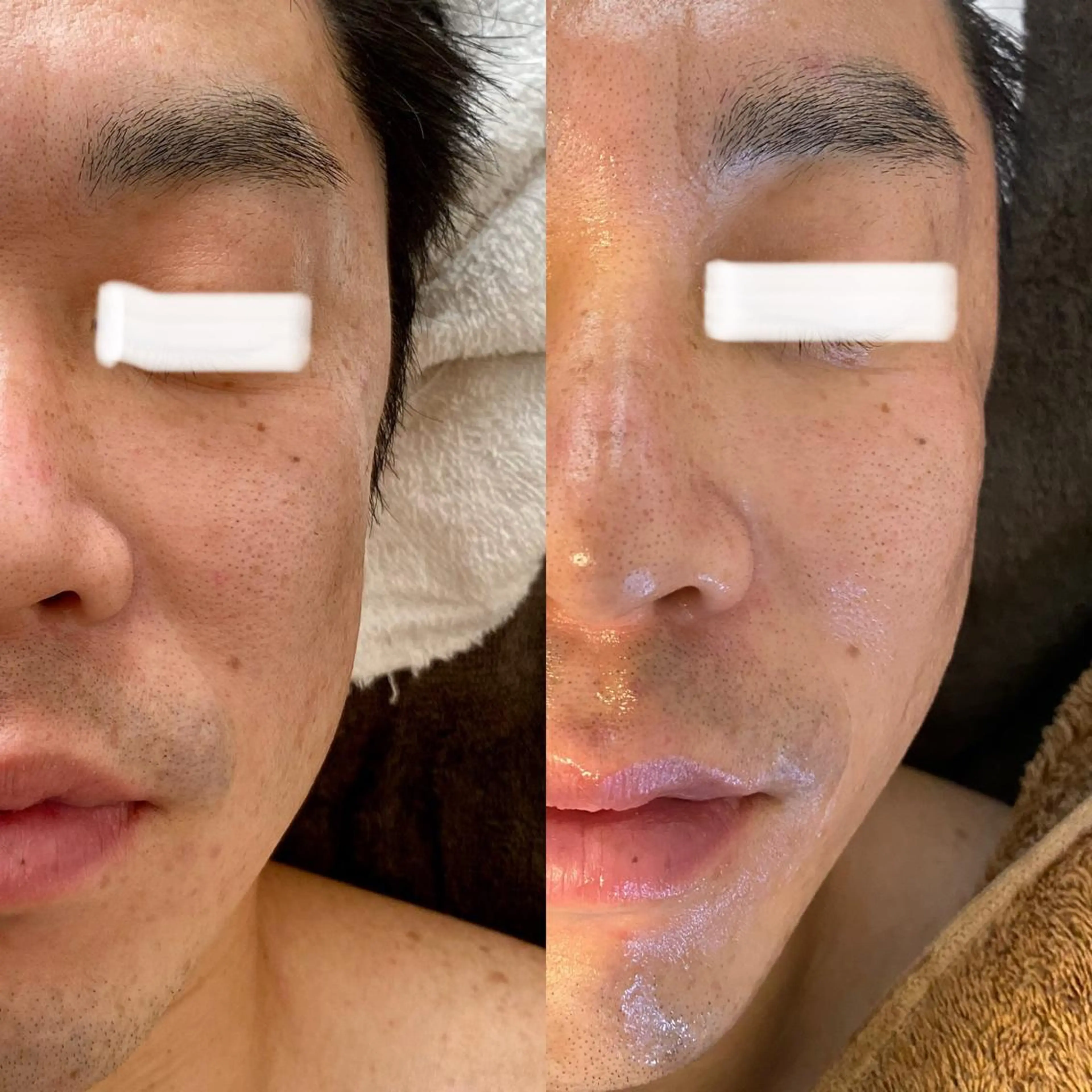 Meetite 小林のエステ・リラクイメージ