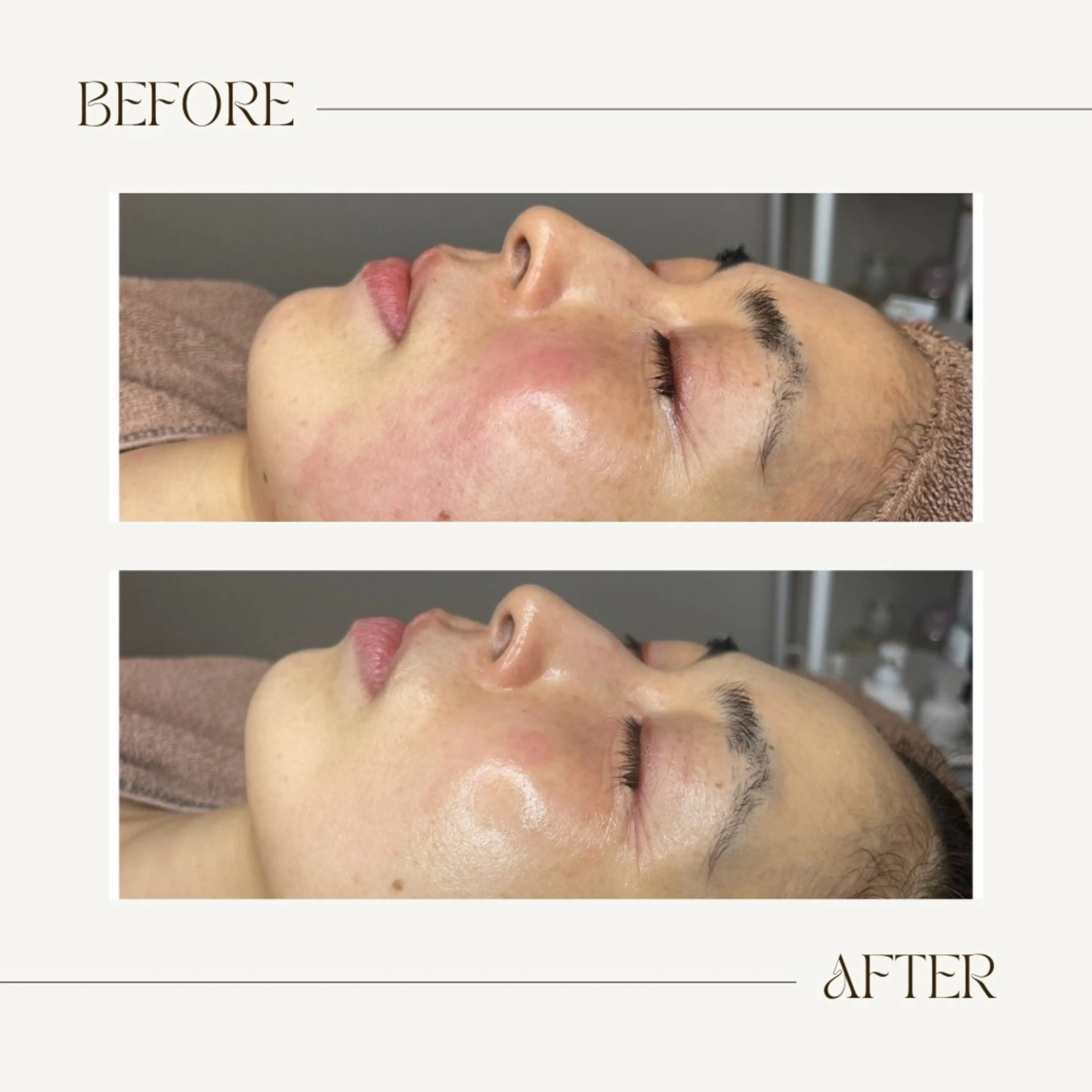 be.me maiのエステ・リラクイメージ