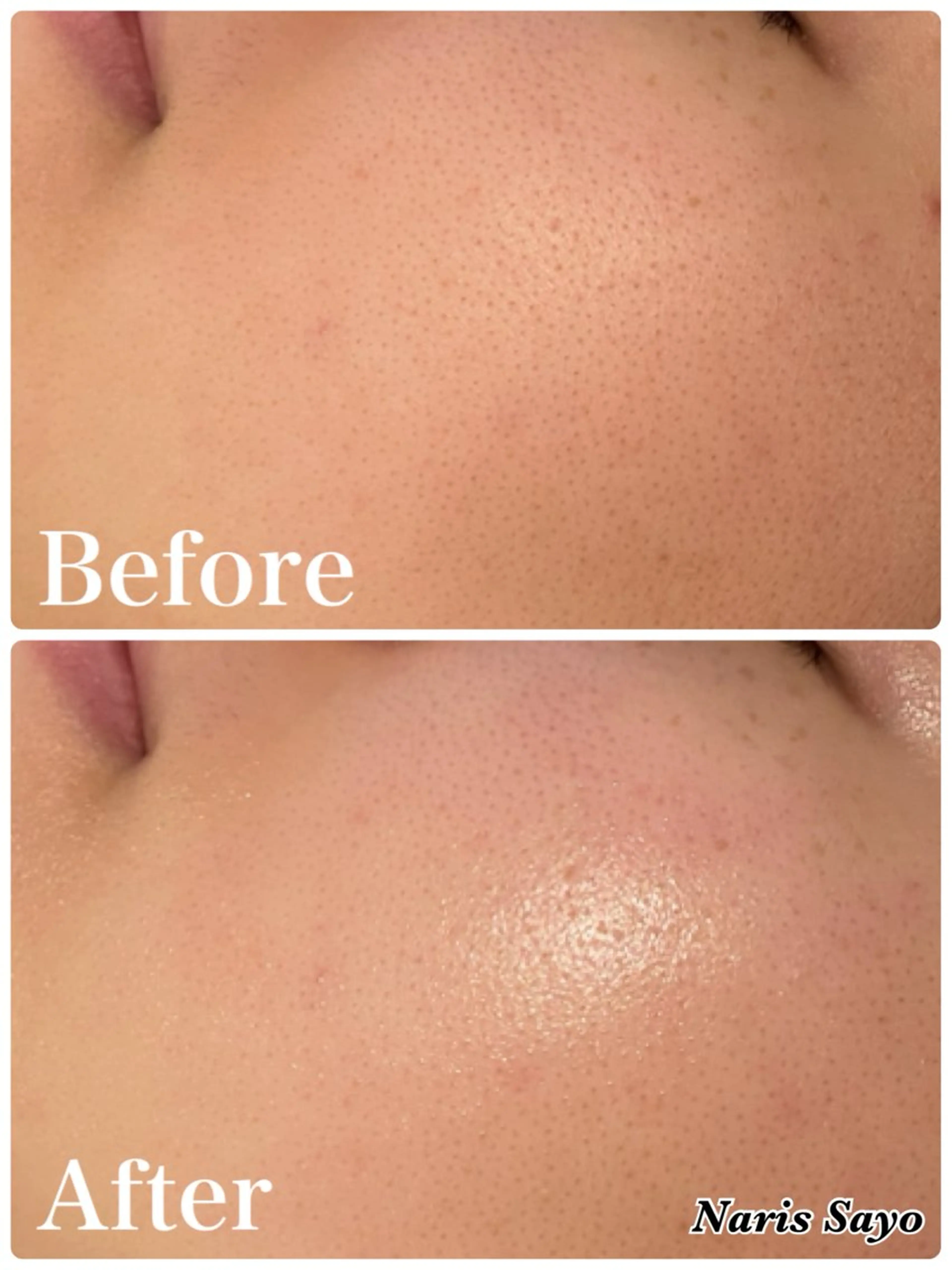 デ・アイム豊中所属・朝山 紗世子のエステ・リラクイメージ