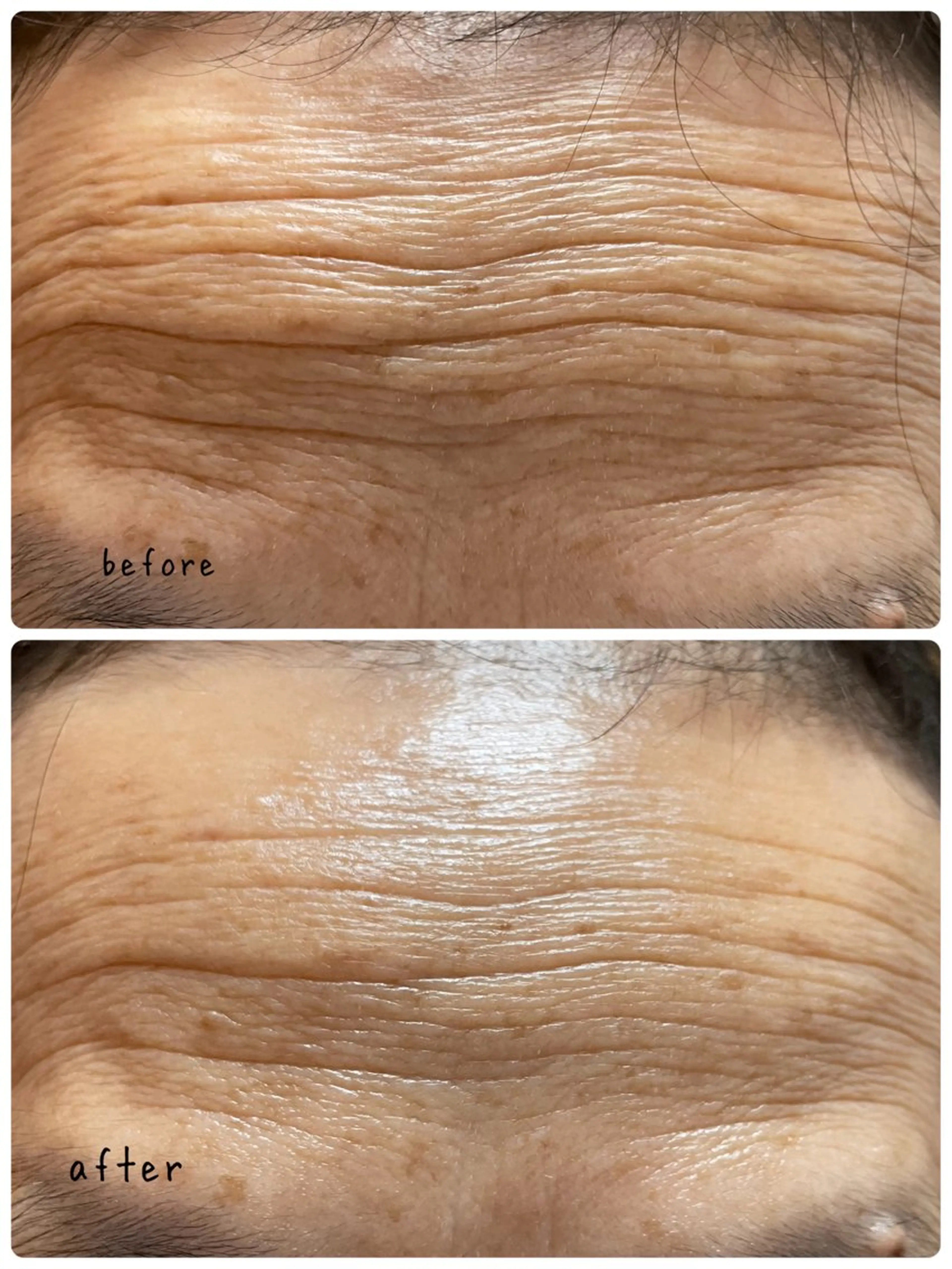 フェイシャルサロンメナード茜部野瀬店所属・メナード　茜部野瀬 長谷部のエステ・リラクイメージ