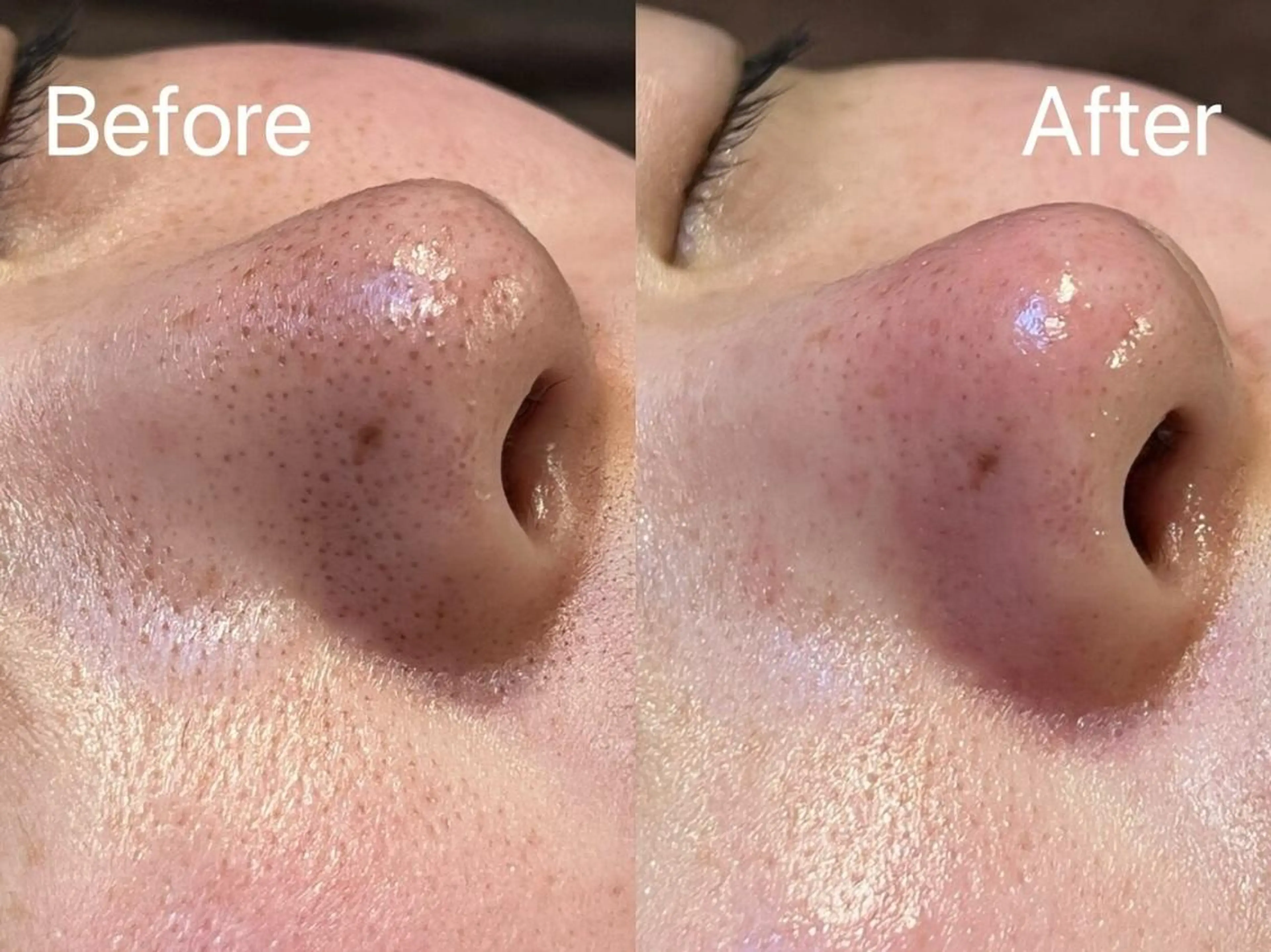 LingK/Este 駒田 辰玲のエステ・リラクイメージ