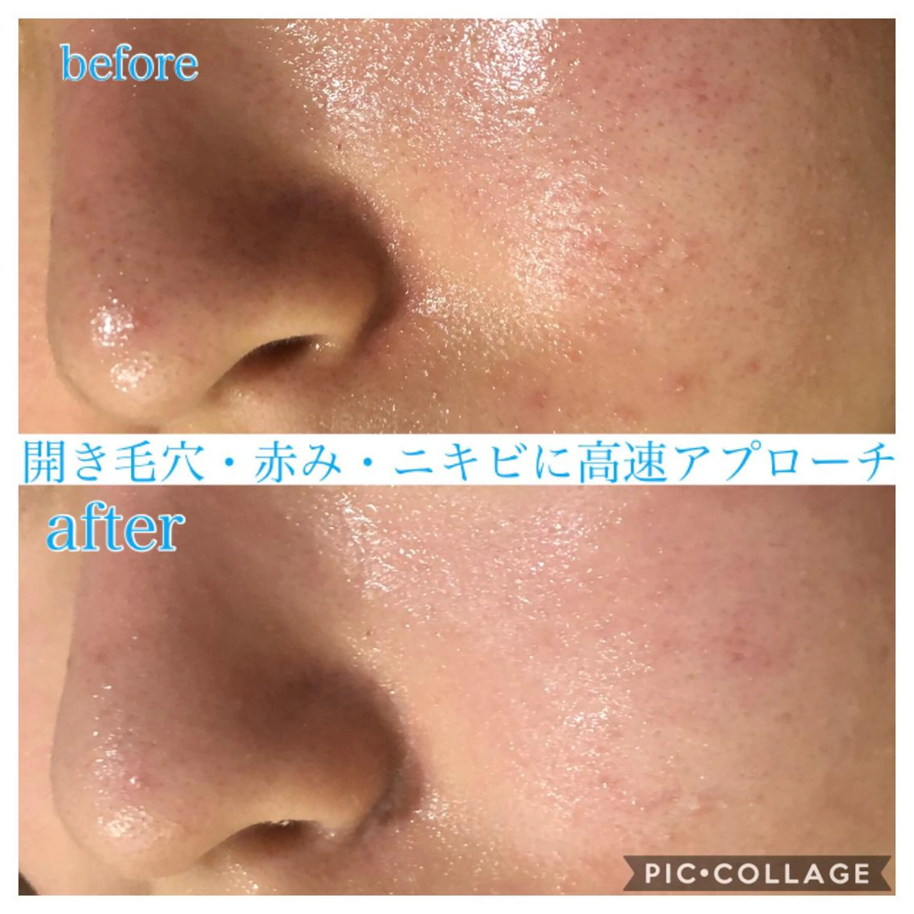 セミロング カラー パーマ ヘアアレンジ キッズ ネイル マツエク・マツパ エステ リラク Ensor Clair所属・EnsorClair 代表 野口真央のエステ・リラクイメージ