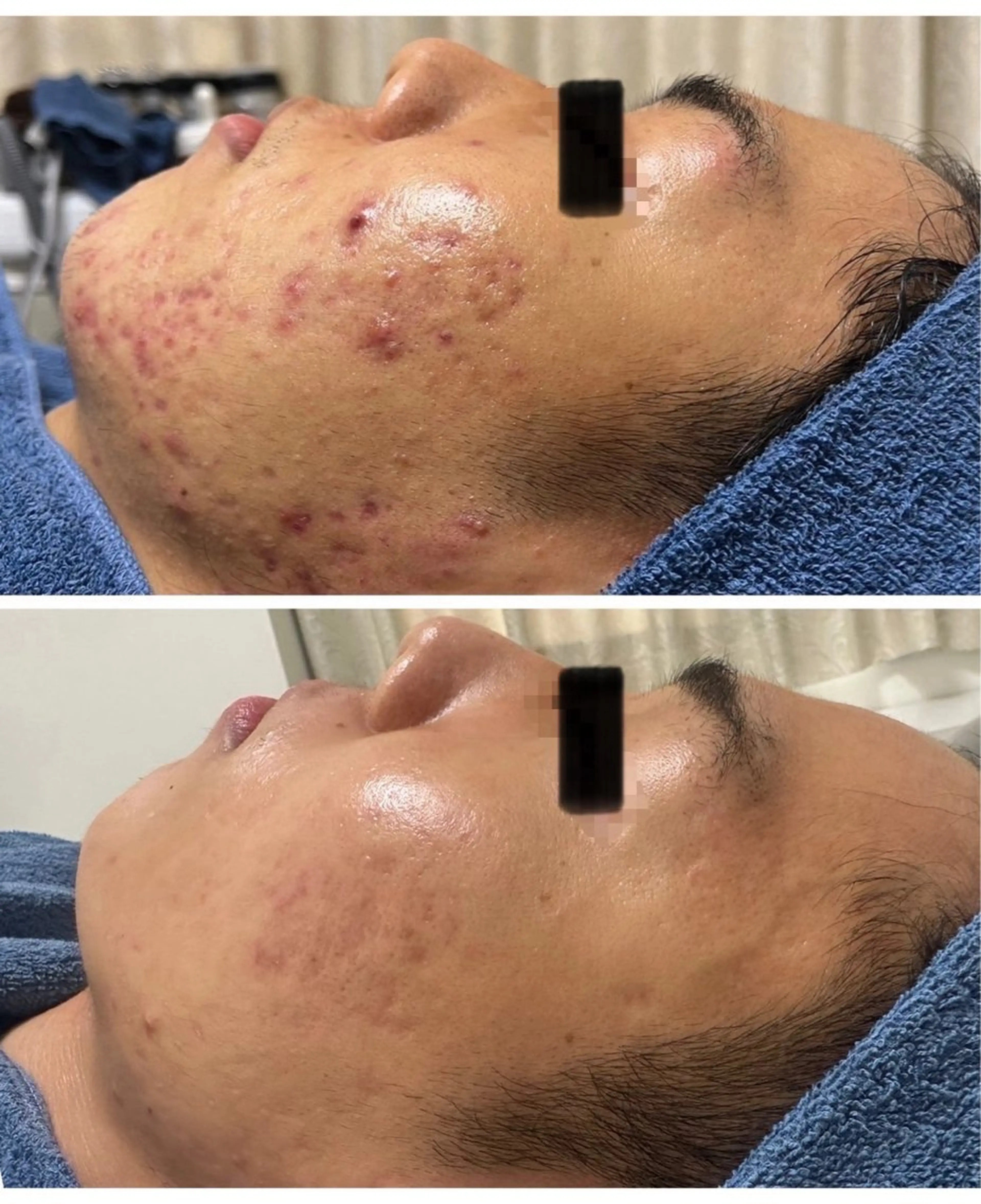 Lussera(ルセラ)所属・肌質を変えて すっぴん肌に✨のその他イメージ