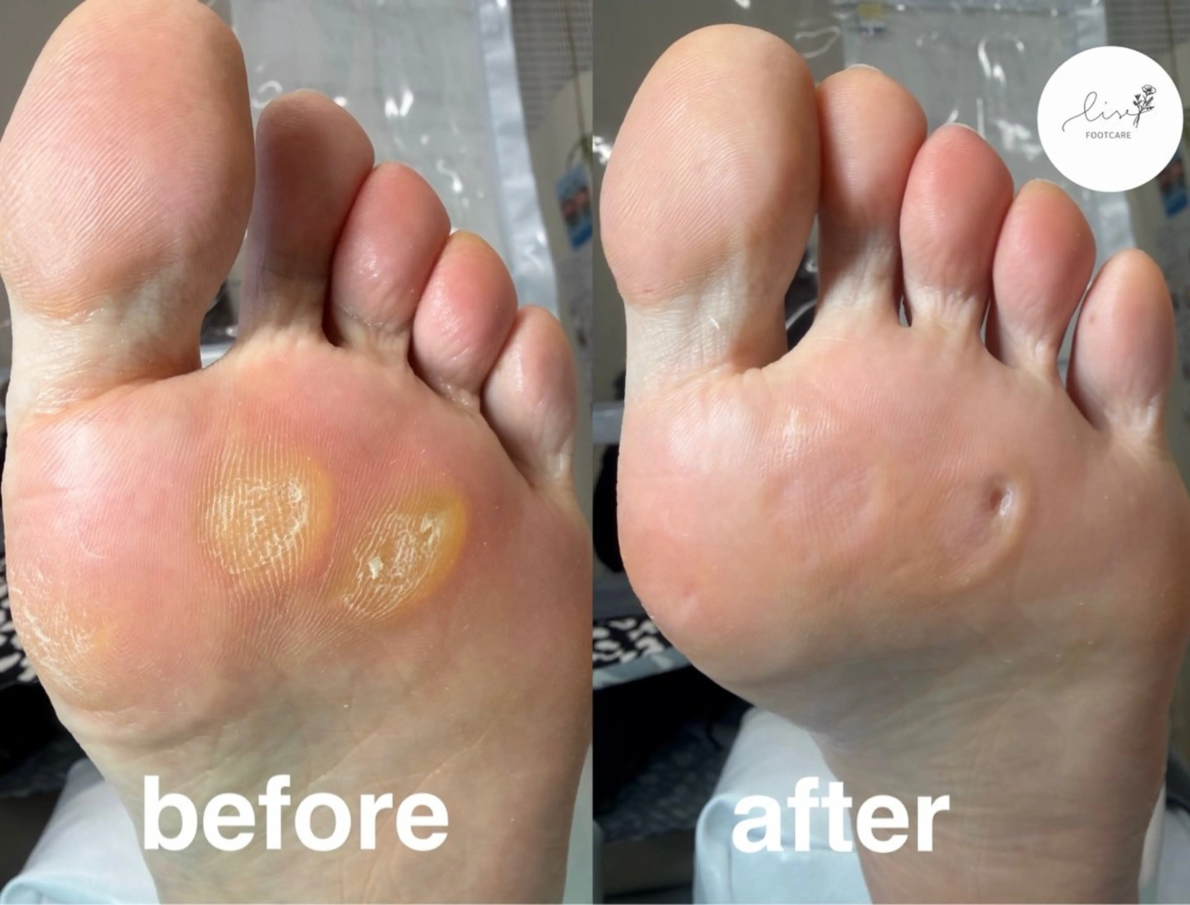 その他(ネイル) Lise footcareのネイルデザイン