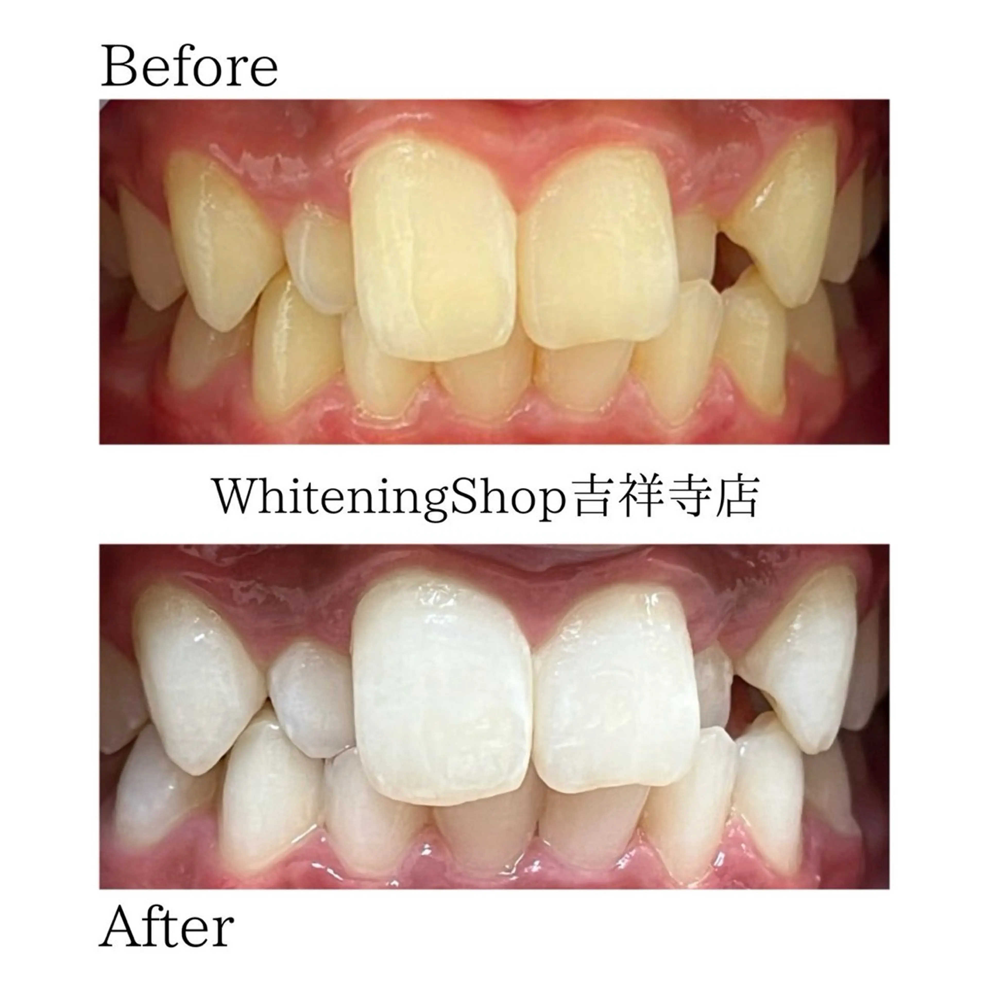 エステ リラク ホワイトニング ショップ吉祥寺店のエステ・リラクイメージ