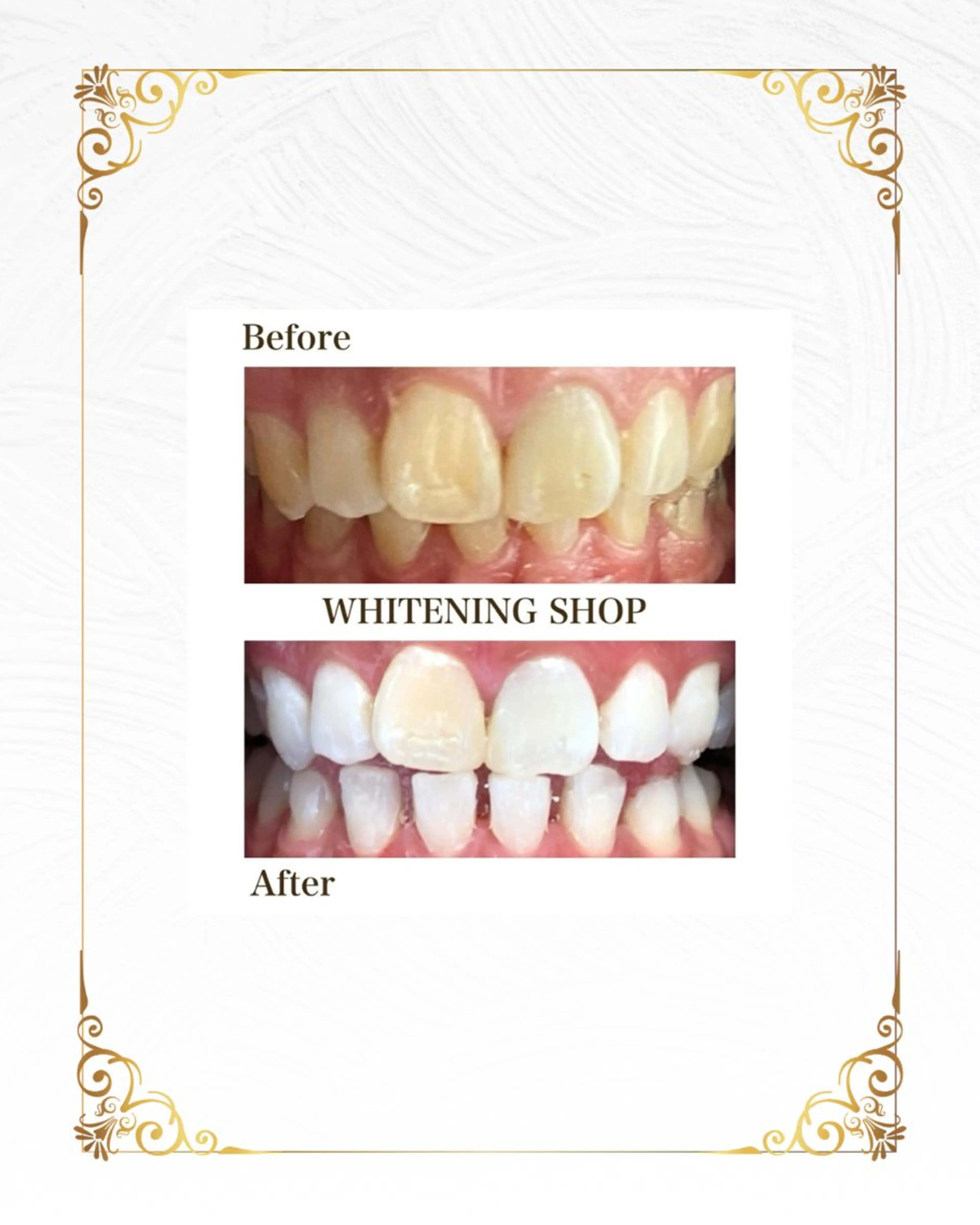 ホワイトニングショップ静岡葵区店所属・ホワイトニング ショップ葵区静岡駅店のその他イメージ