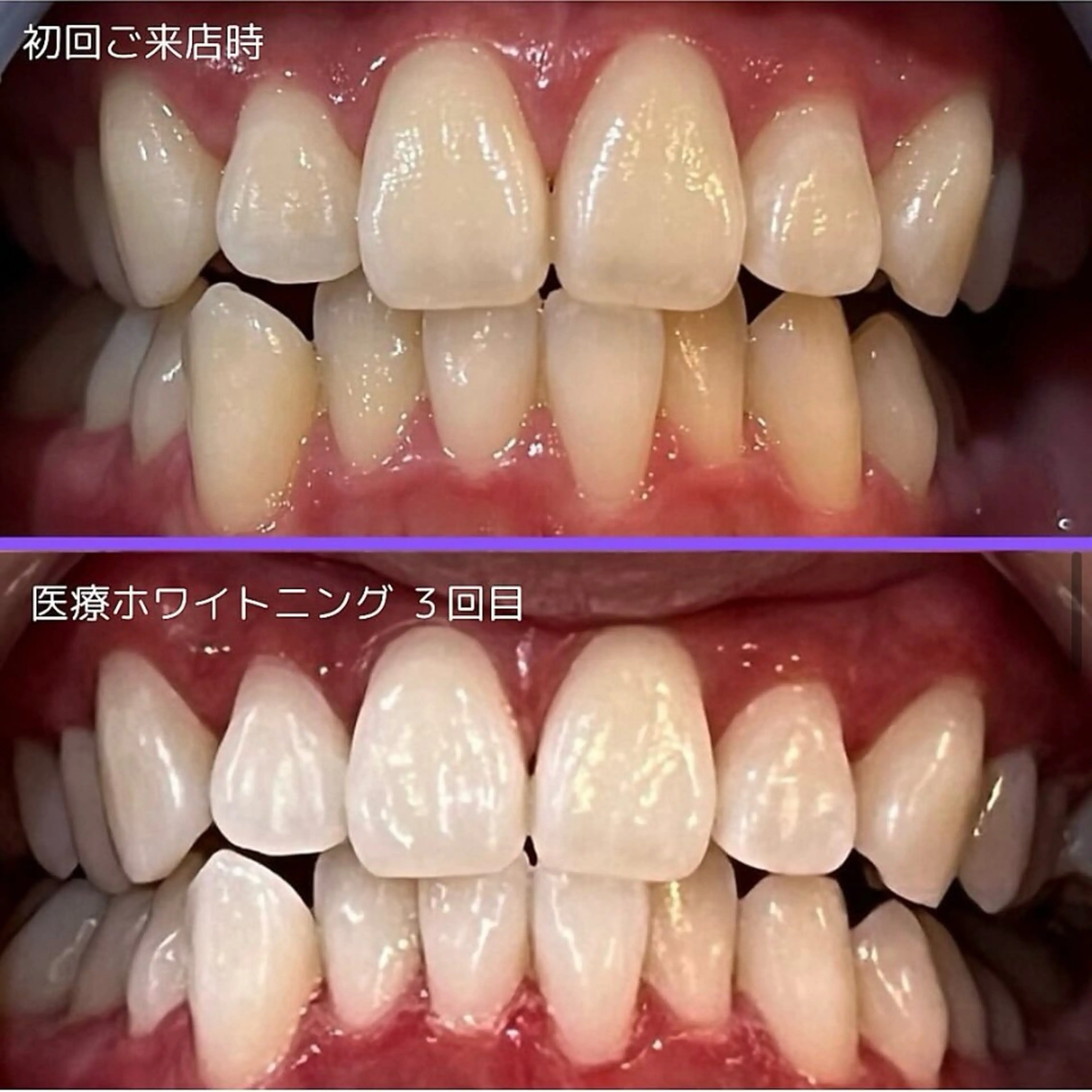 その他 salon 87 【サロン　ハナ】のその他イメージ