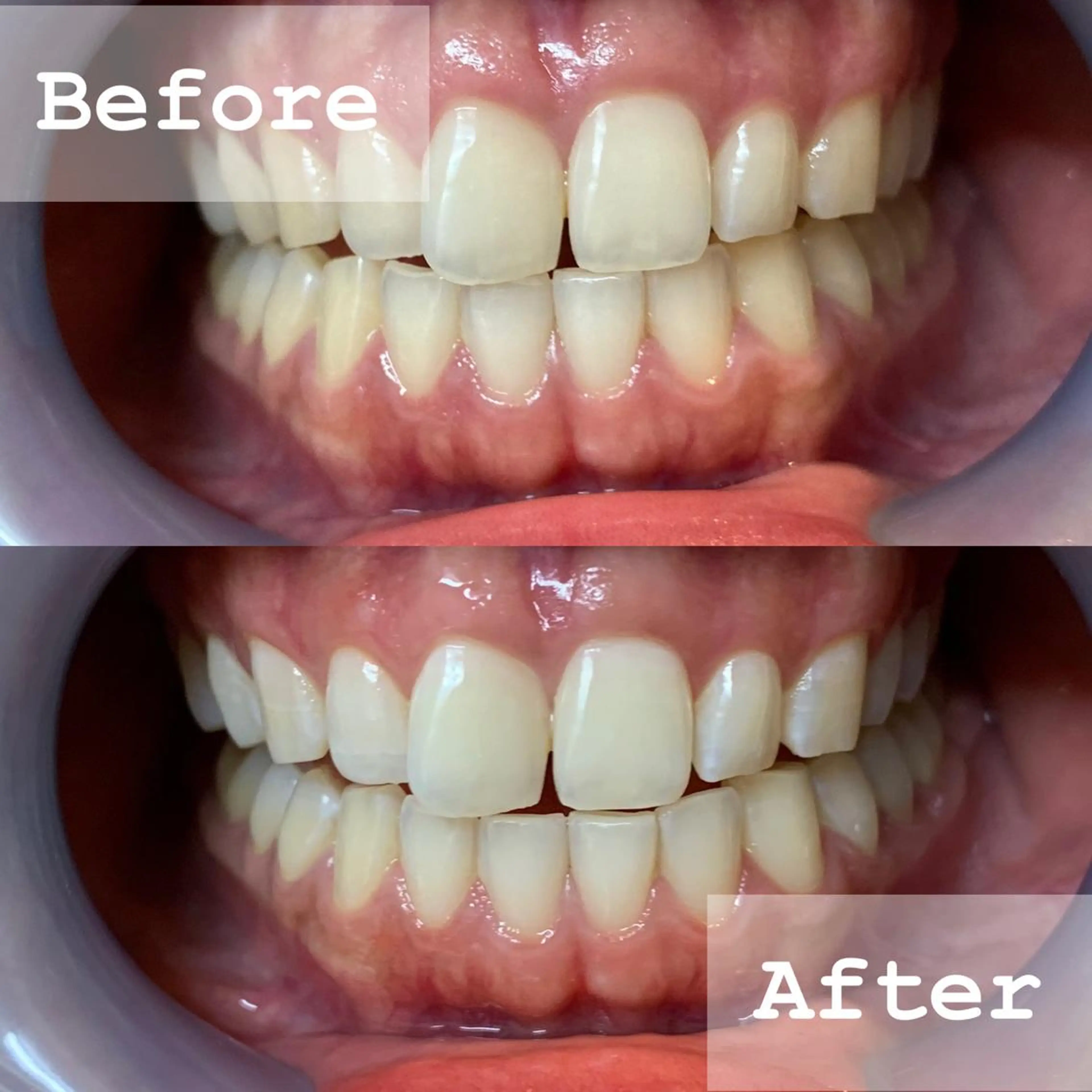 LBSホワイトニング 新宿店💝店長熊倉のエステ・リラクイメージ