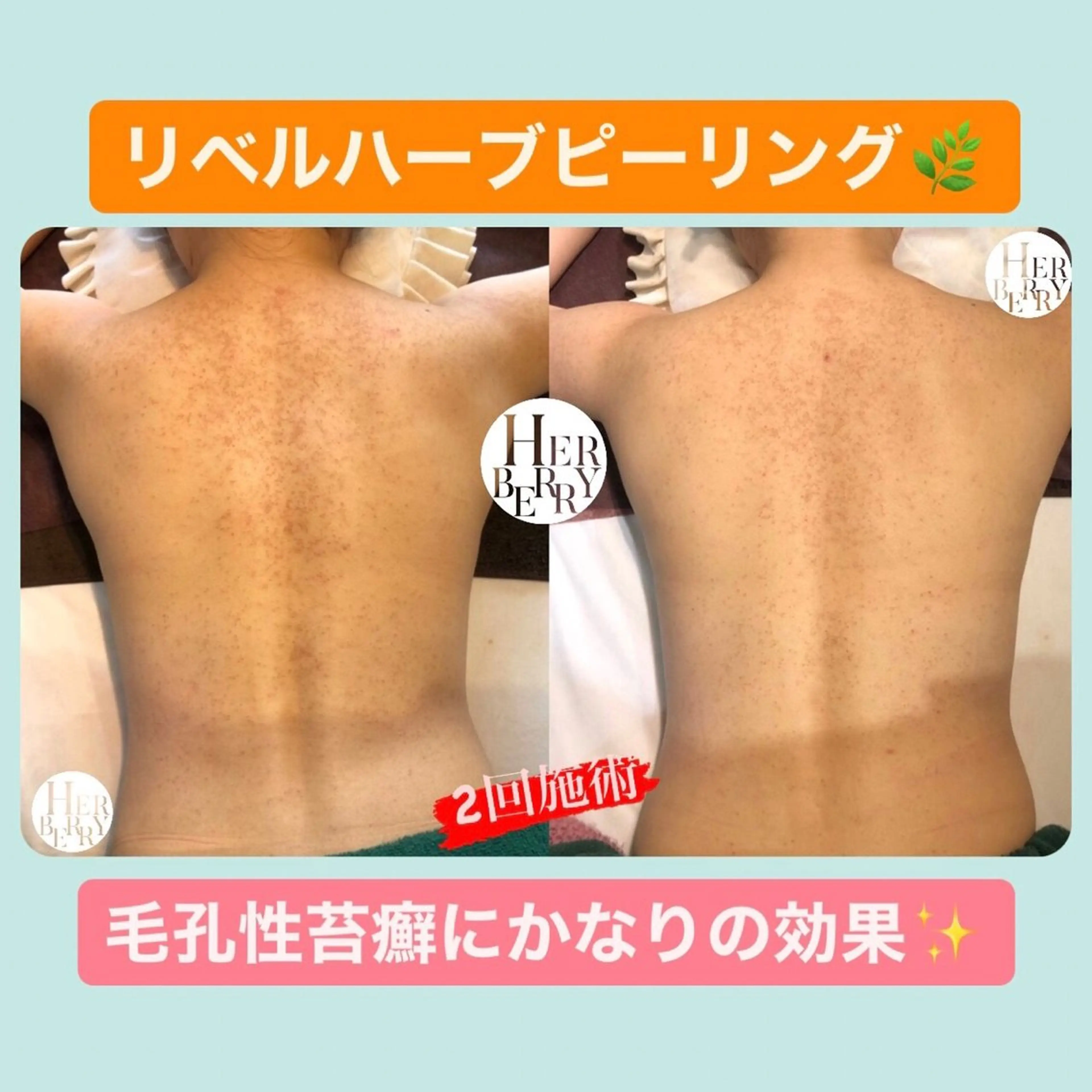ハーブピーリング専門店HERBERRY難波心斎橋店所属・ハーブピーリング専門 HERBERRY冨永のエステ・リラクイメージ