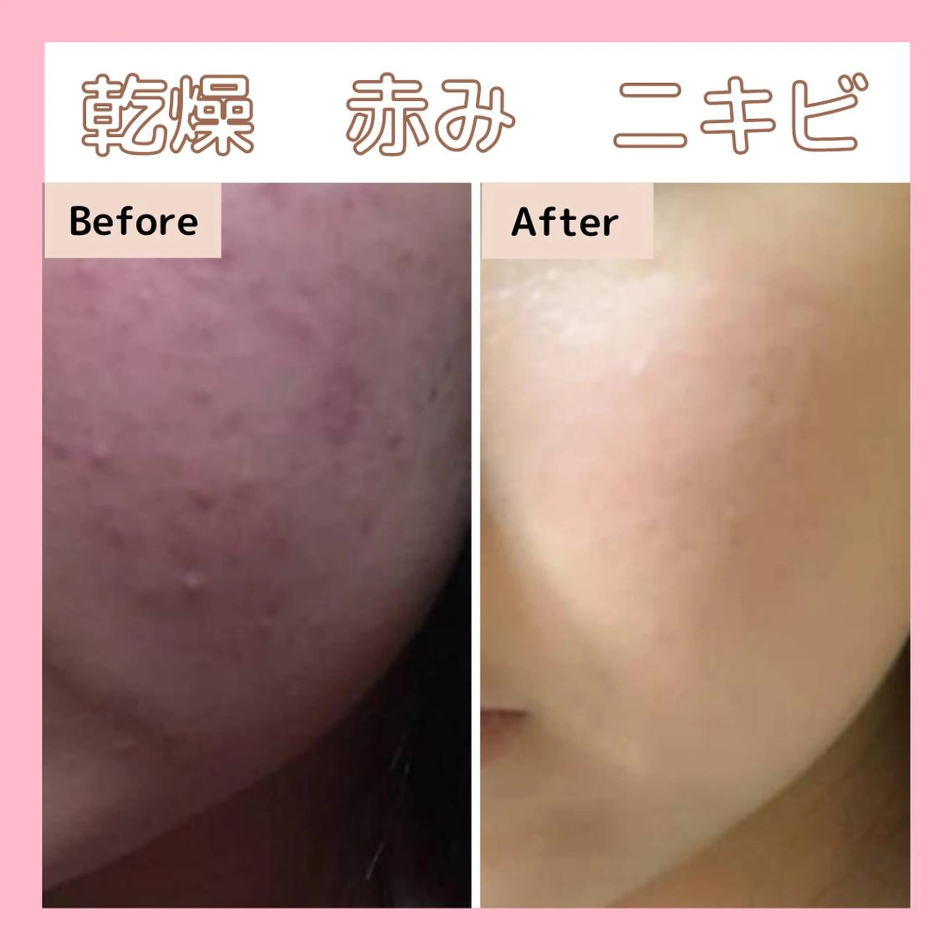 エステサロン　Sブランペタル所属・三沢市エステサロン Sブランペタルのエステ・リラクイメージ