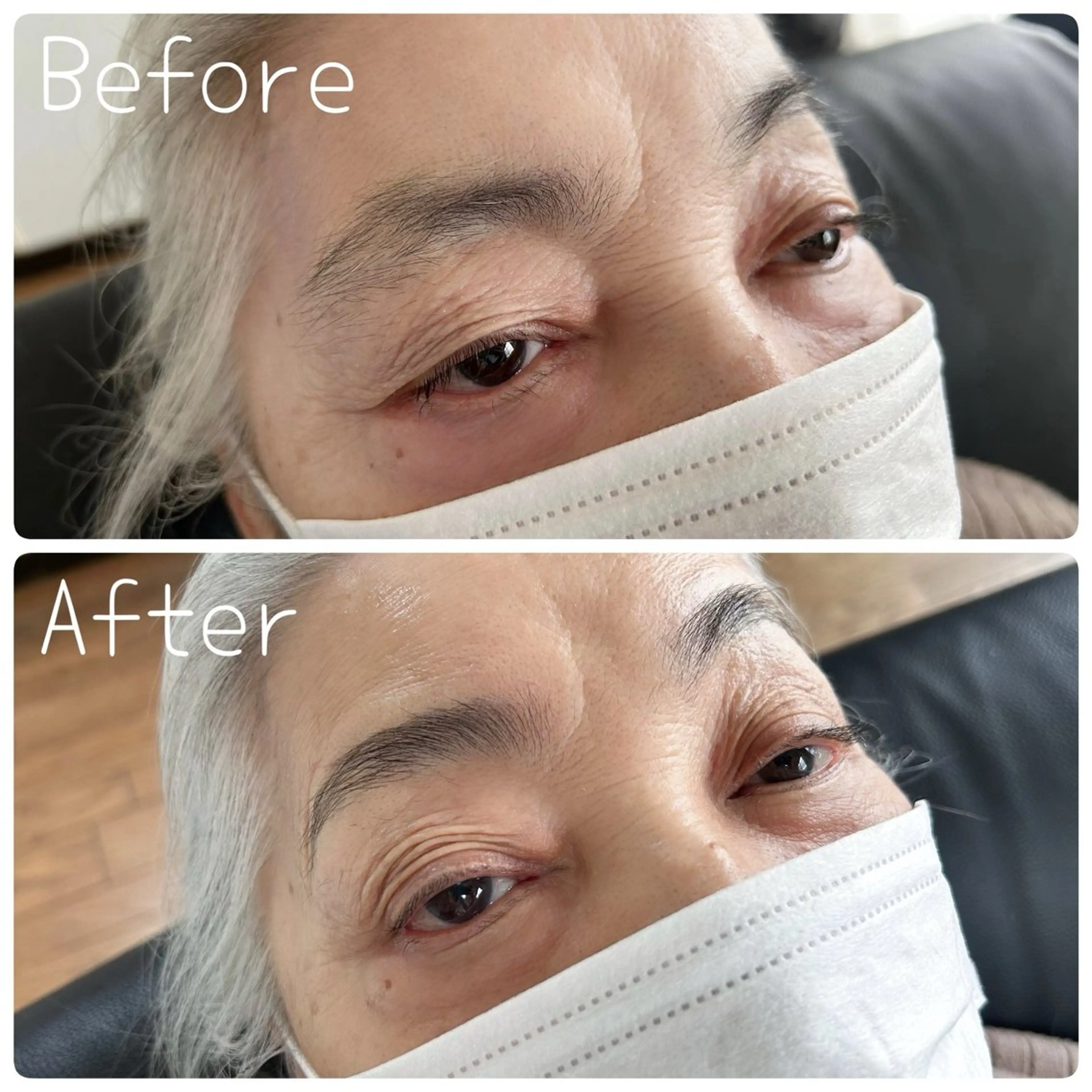 ミラノスタイルブロウリフトの写真