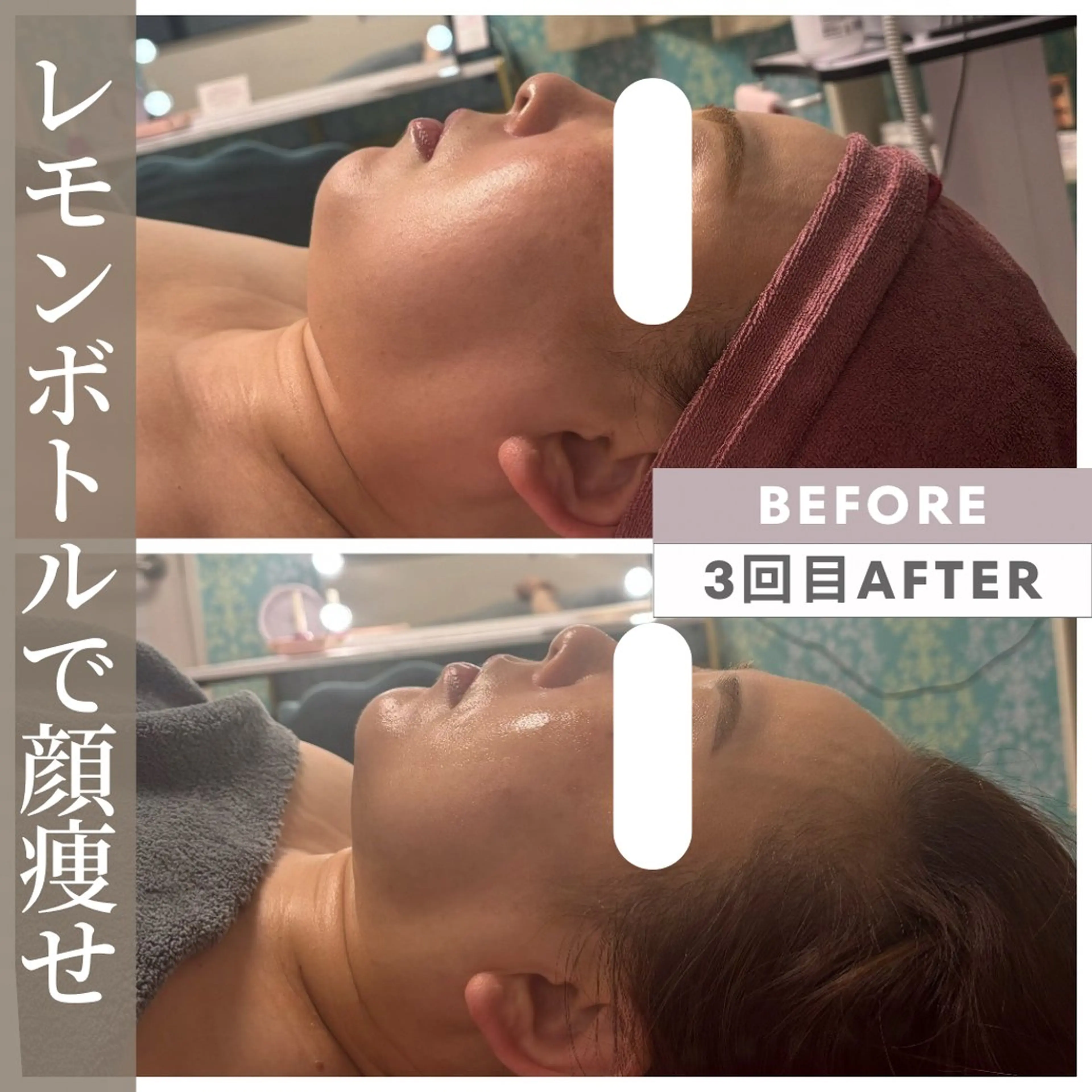 エステ リラク 小顔矯正専門店 【RED】池田のエステ・リラクイメージ