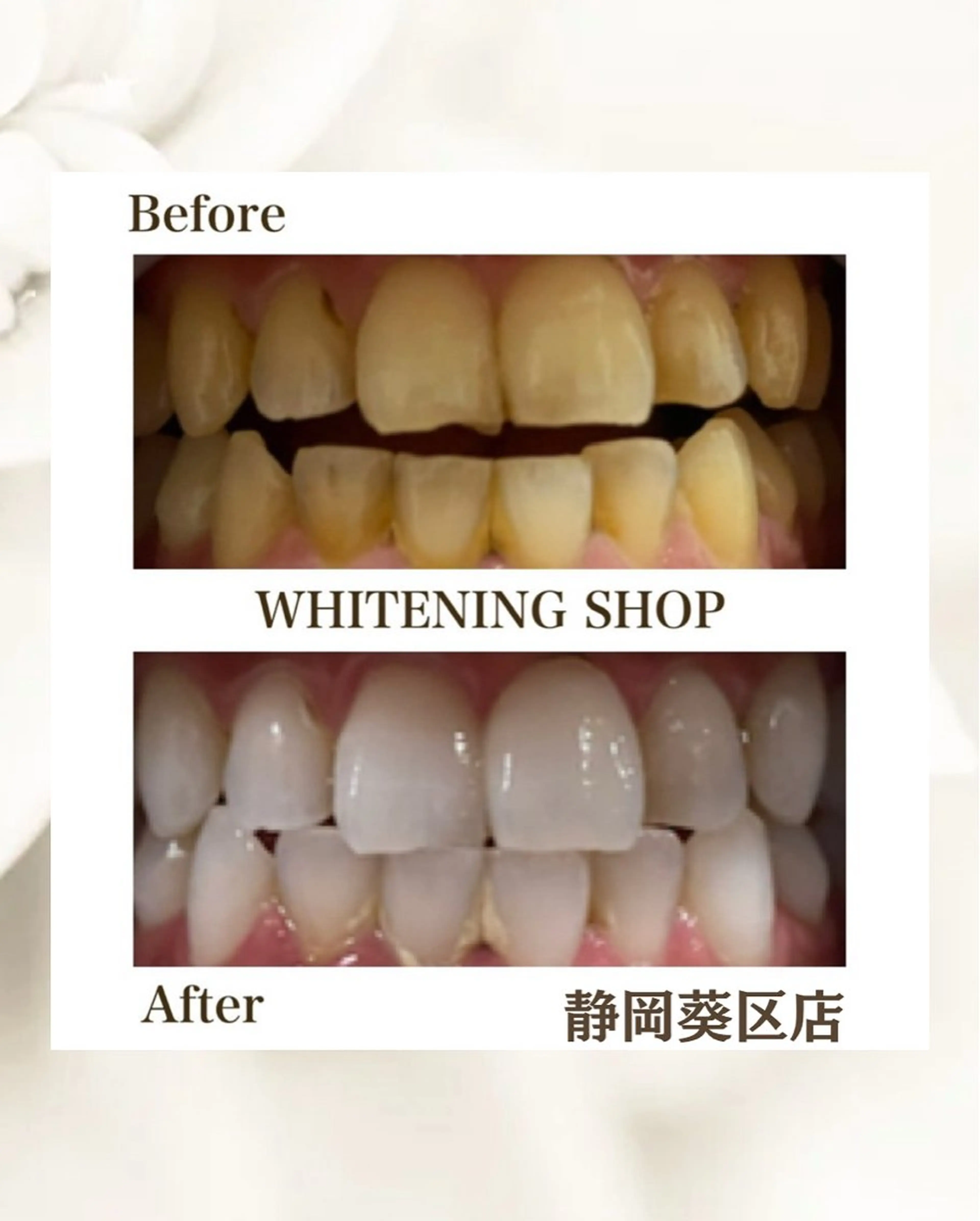 ホワイトニングショップ静岡葵区店所属・ホワイトニング ショップ葵区静岡駅店のその他イメージ