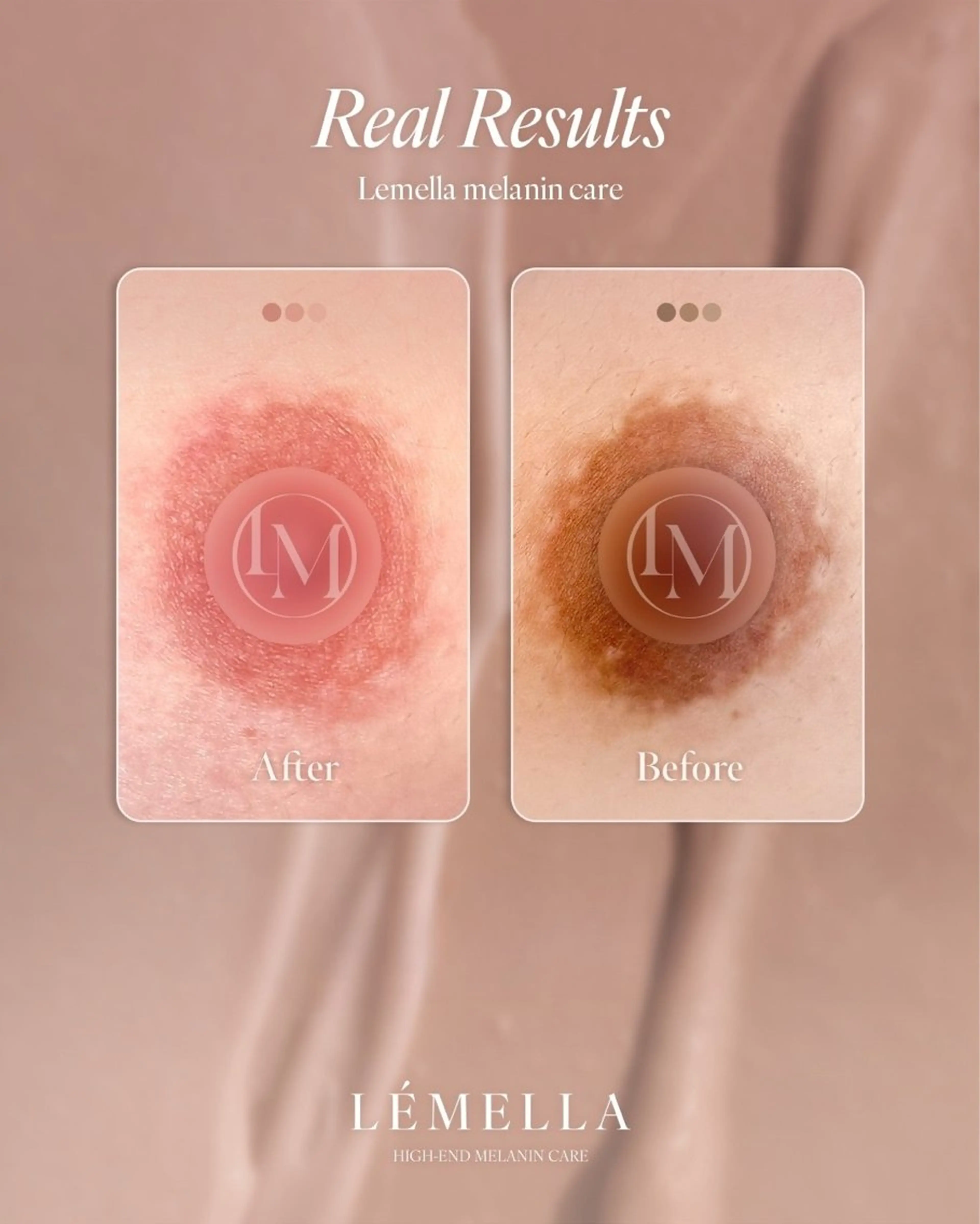 ネイル その他 extranails /lemellaのネイルデザイン