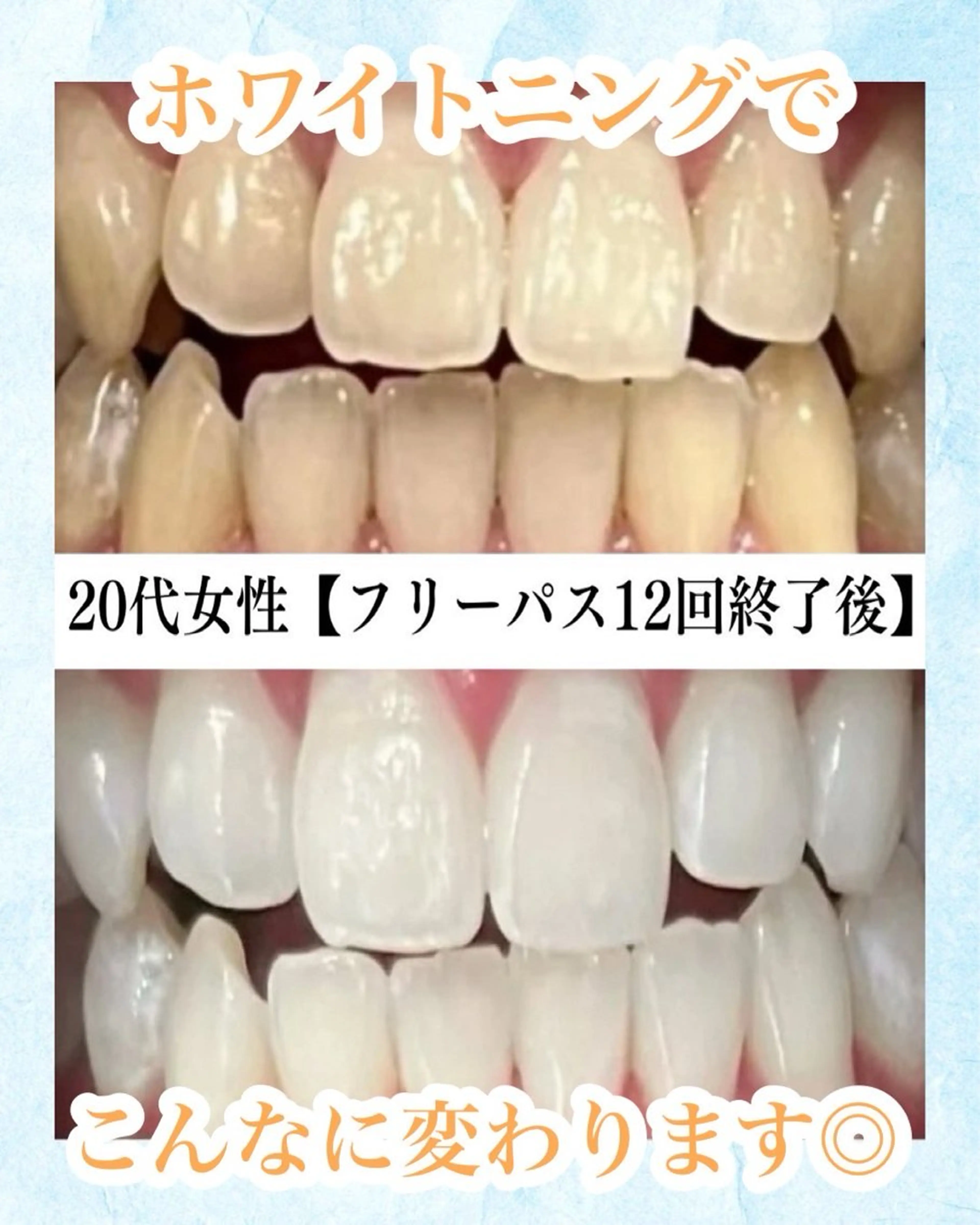 メンズ キッズ エステ リラク ホワイトニング専門店 WHITE天神店のエステ・リラクイメージ