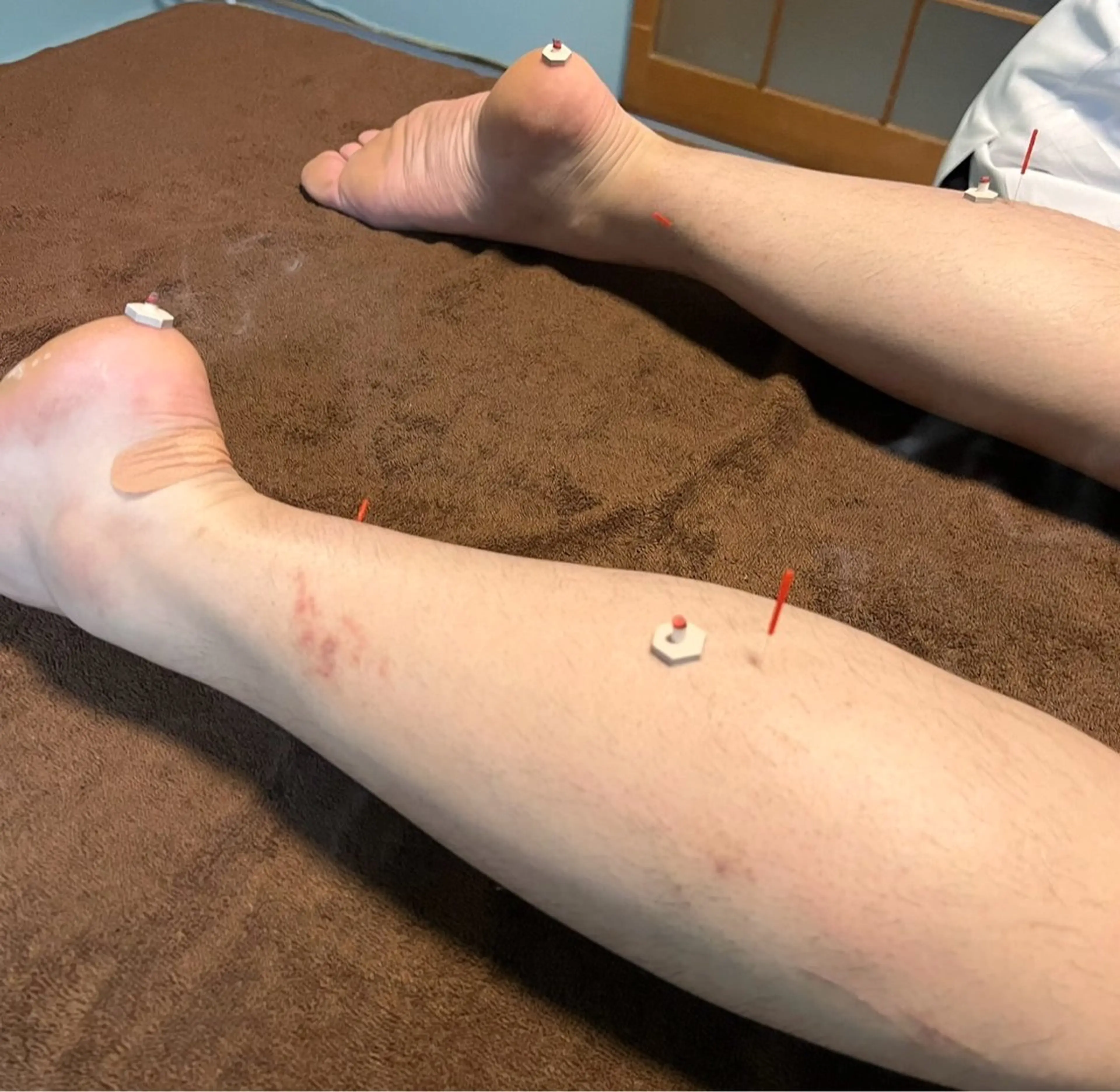 たくみ鍼灸整体所属・後藤 巧のエステ・リラクイメージ