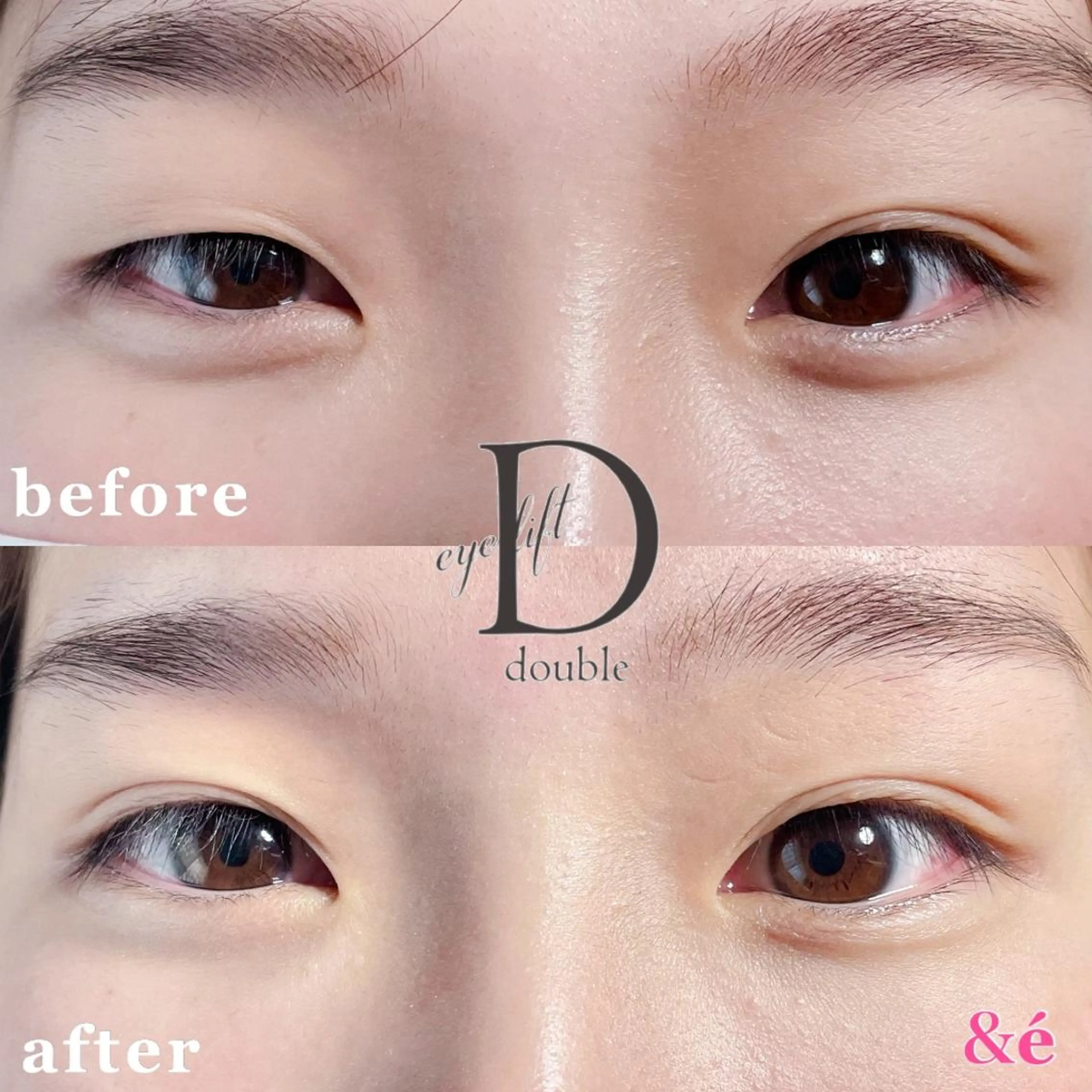 【ご新規様 】ダブルアイリフトの写真