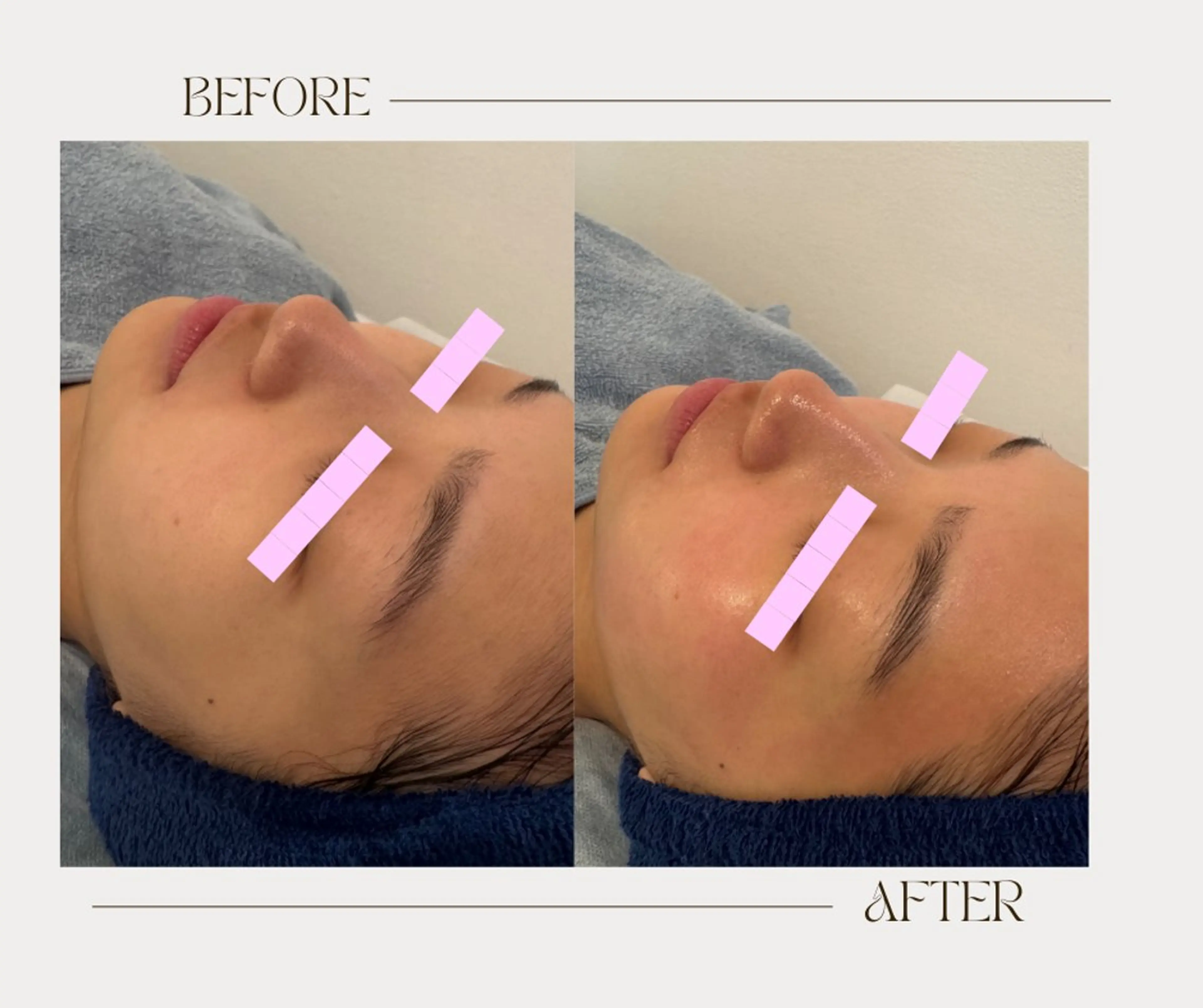 エステ 艶肌ワックス ALLY.のエステ・リラクイメージ