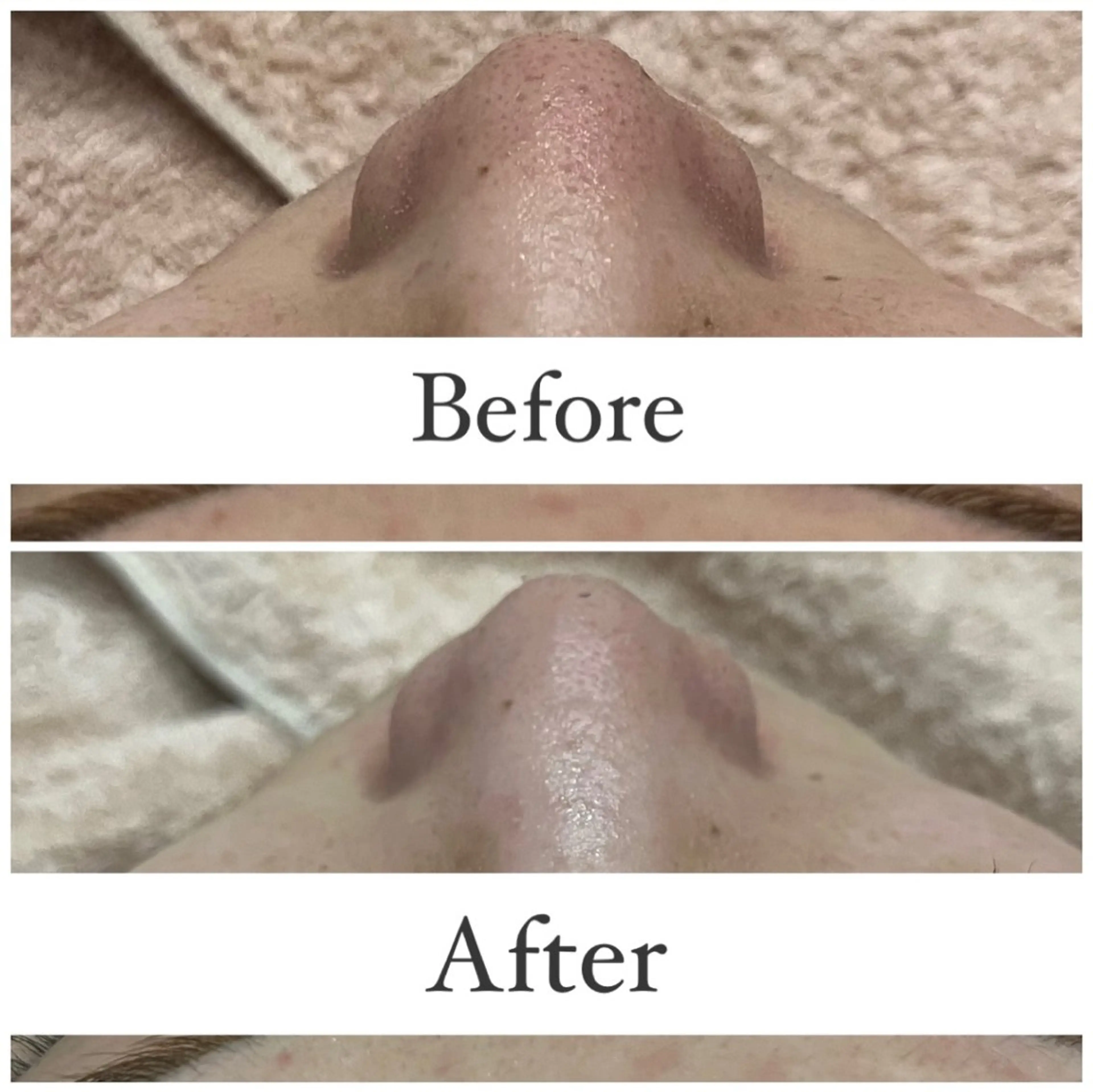 ハーブピーリング専門 muro.のエステ・リラクイメージ