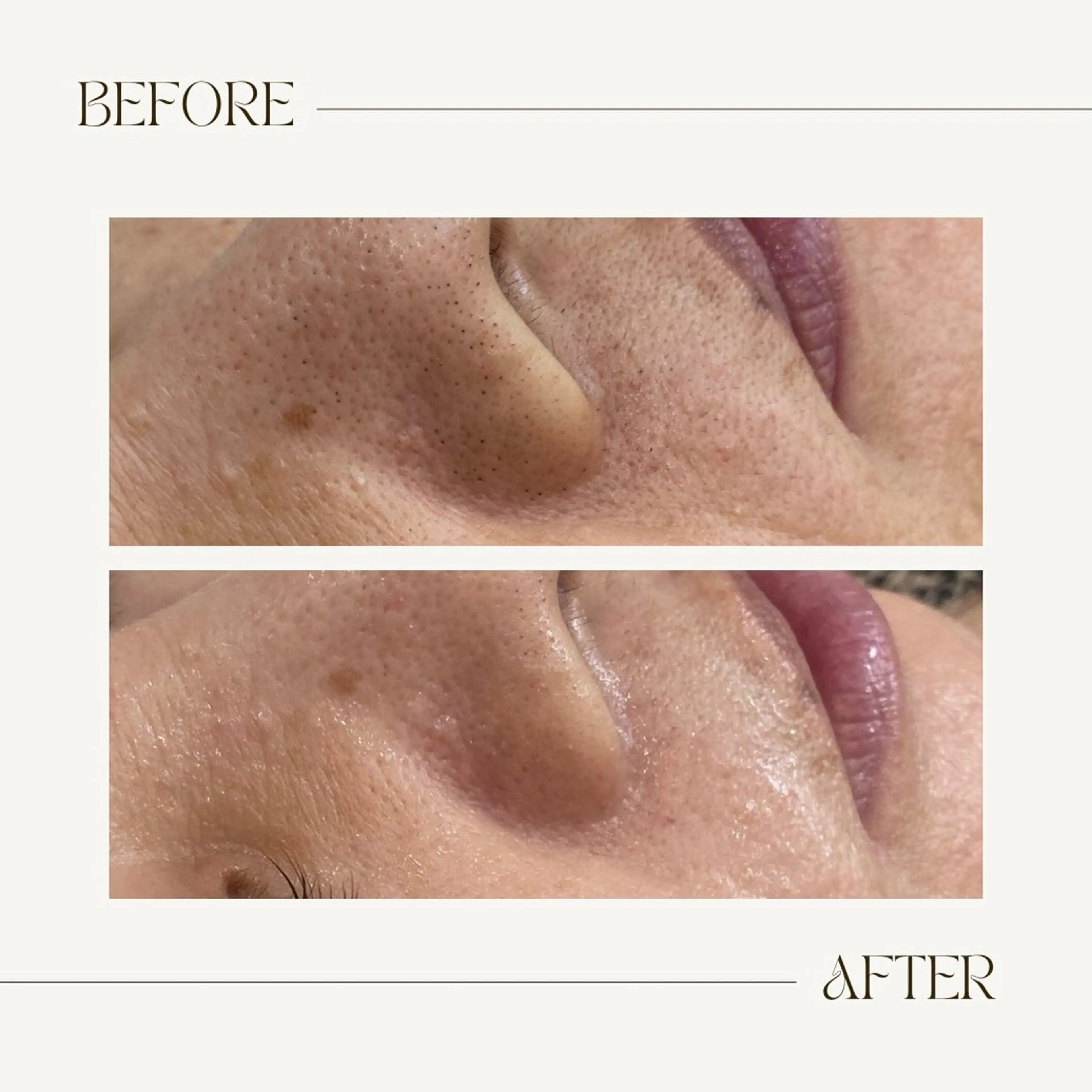 CEsalonEgg 齋藤のエステ・リラクイメージ