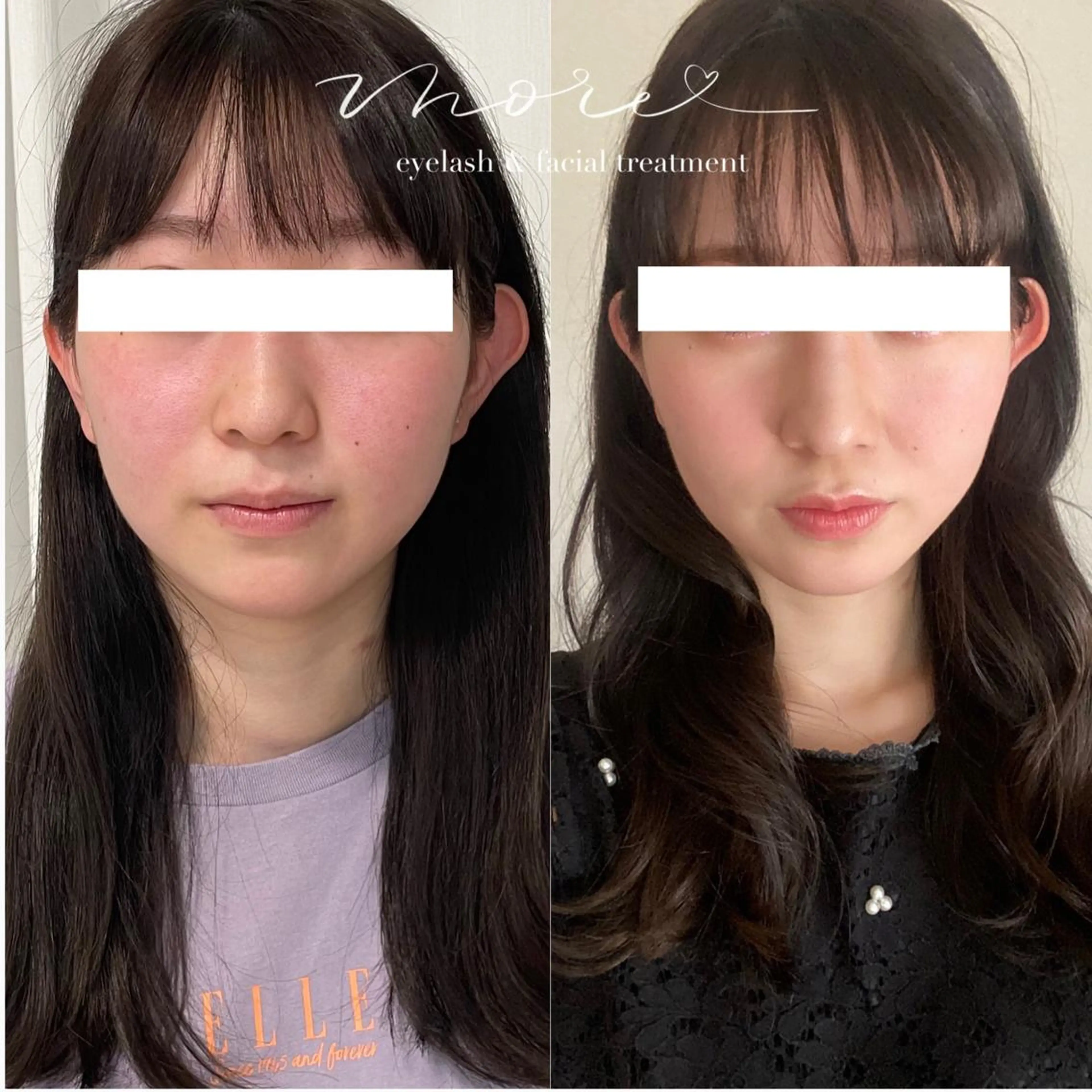 Eyelash salon MORE(モア)所属・安納 麻穂のエステ・リラクイメージ