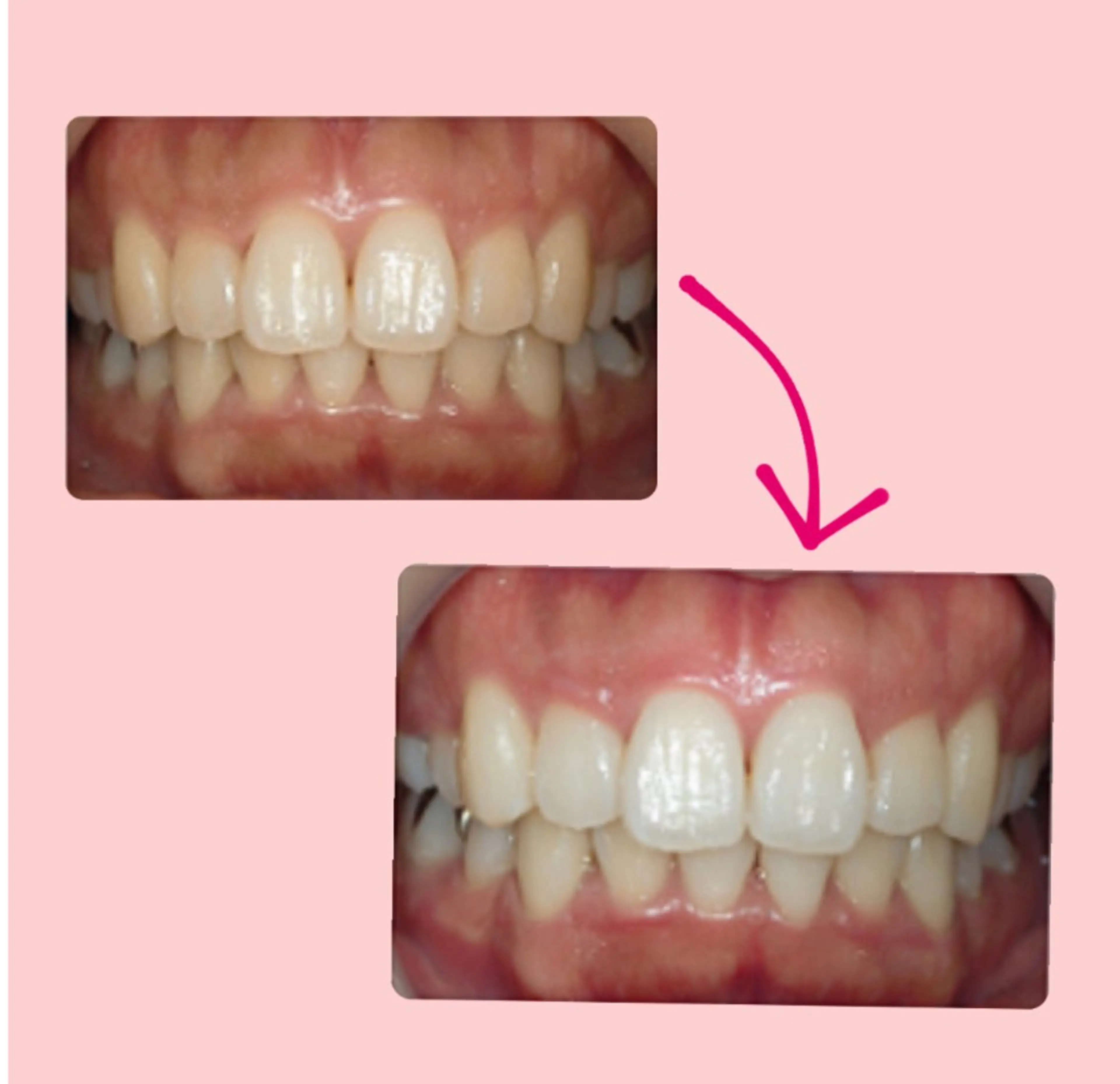 その他 エクシアホワイトニング草津店所属・nanami -ホワイトニングのその他イメージ