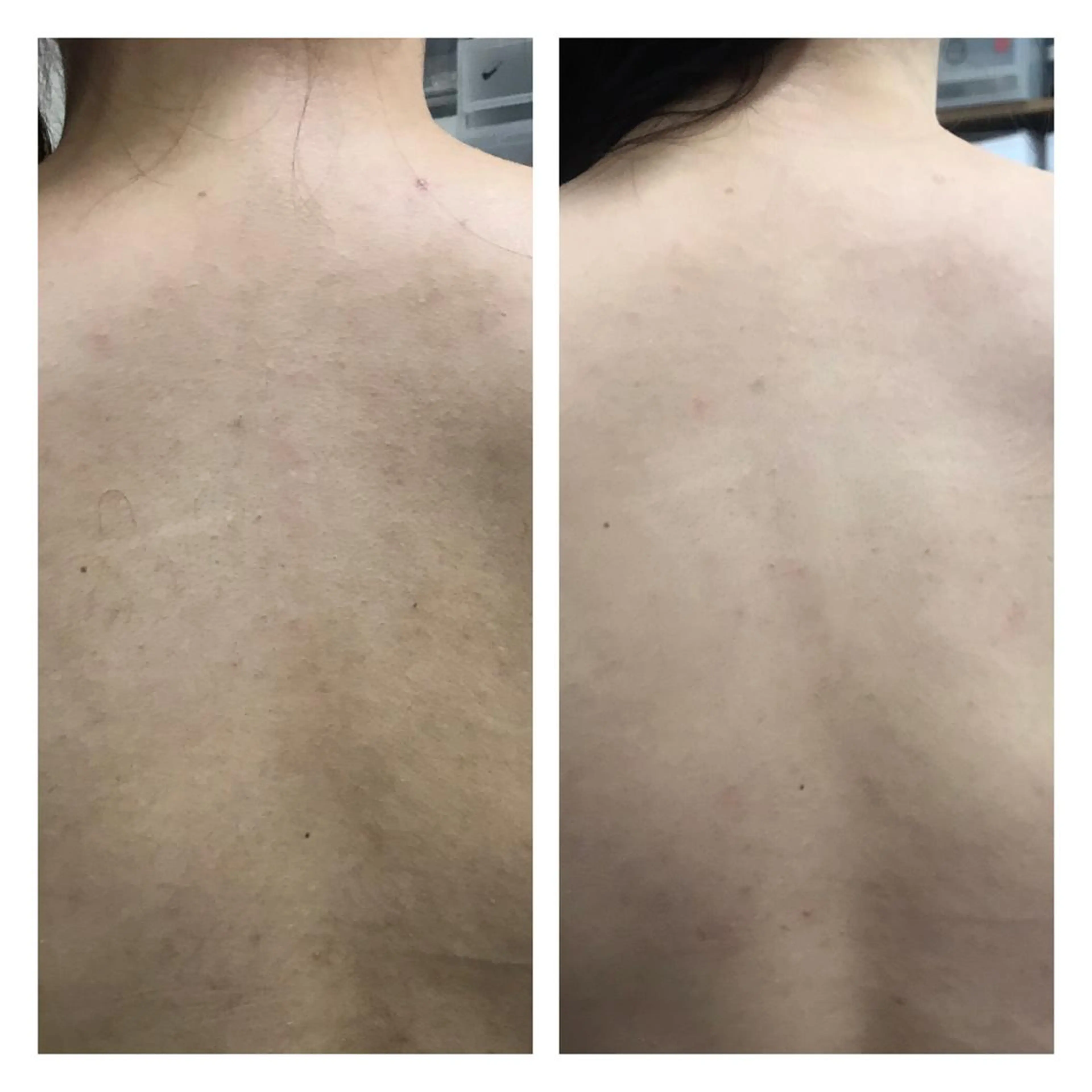 エステ 【足圧】鬼👹リンパ 身体整うサロンのエステ・リラクイメージ