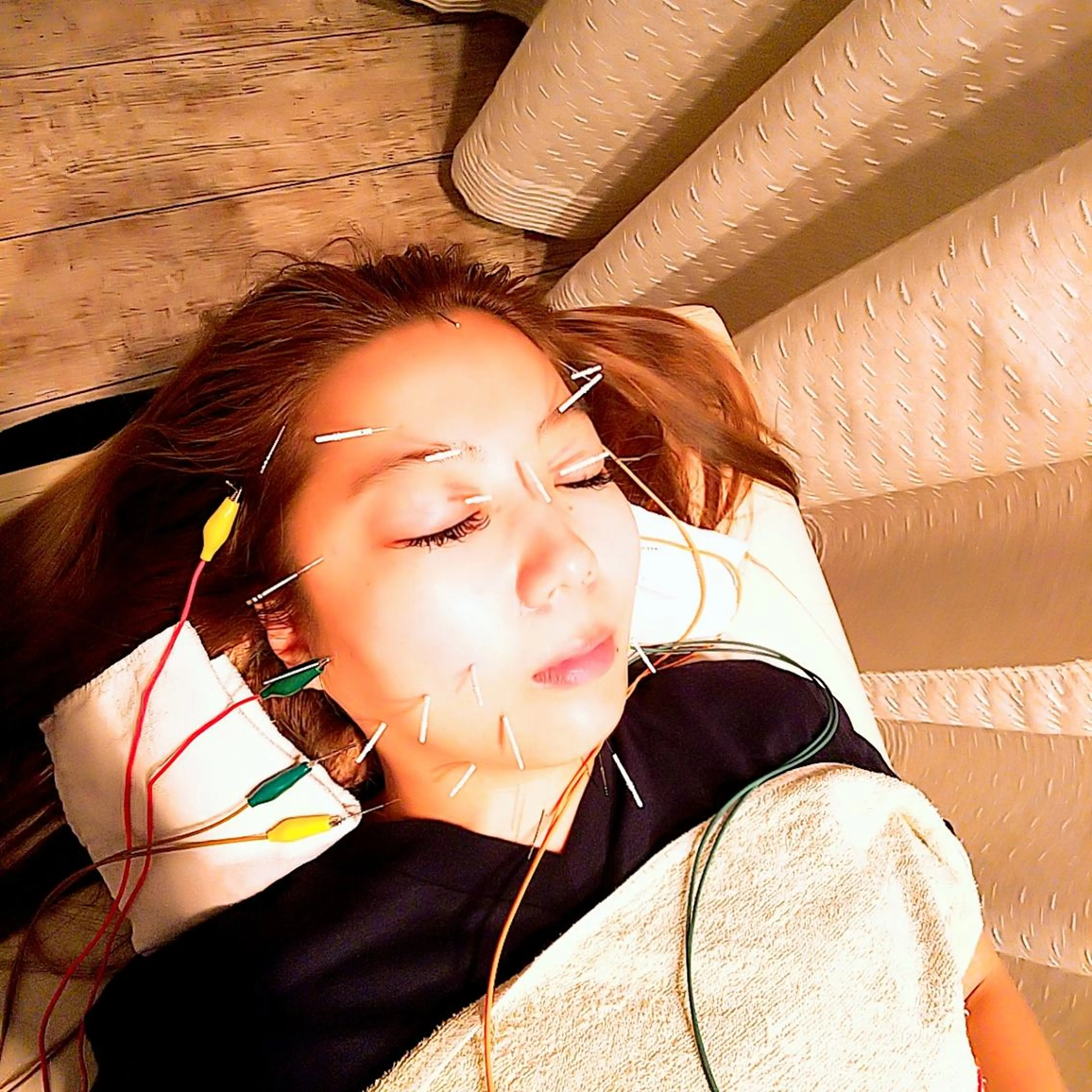 むくみたるみ専門☆ 美容鍼・小顔矯正のエステ・リラクイメージ