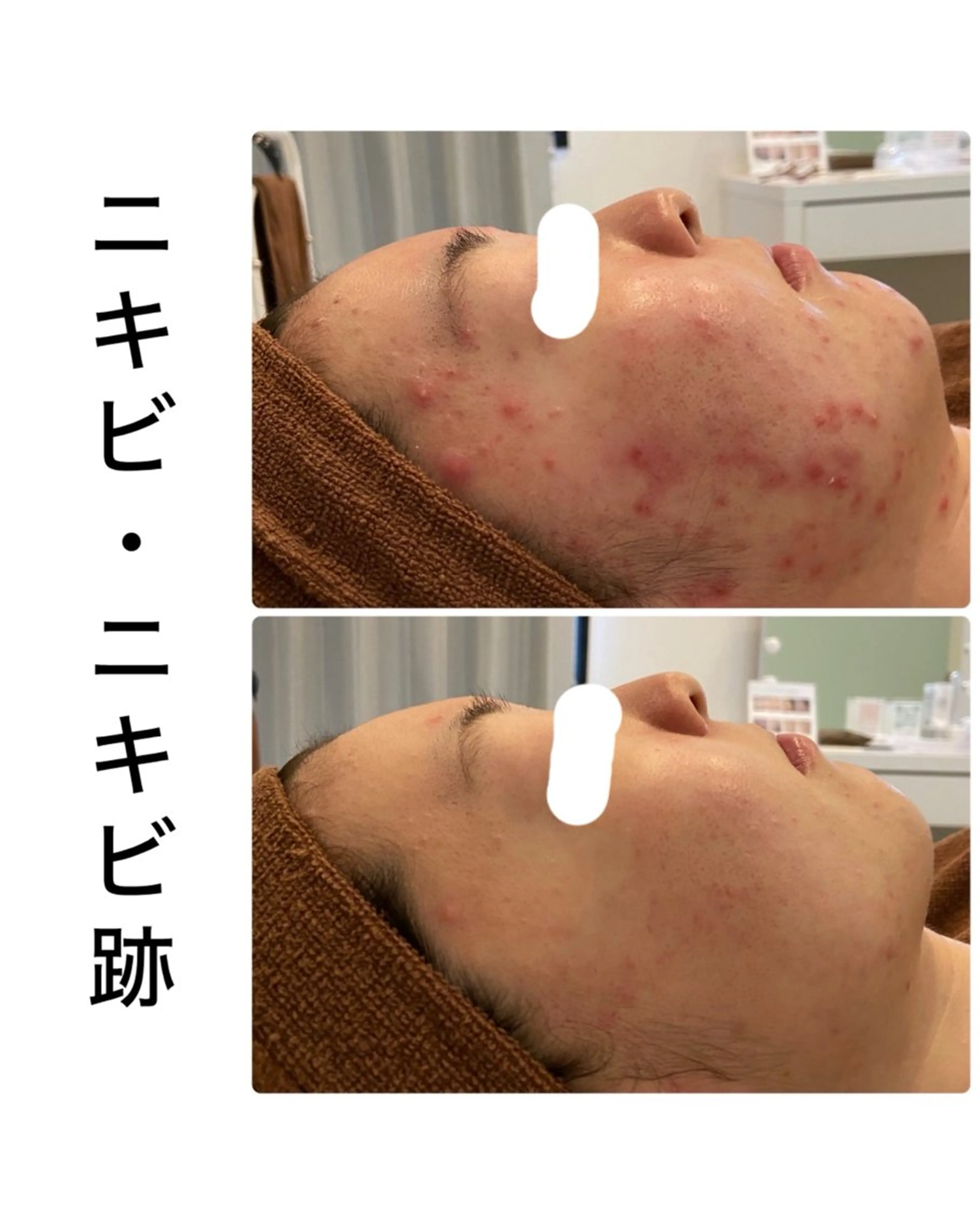 その他 ハーブピーリング専門 BIOPLUS＋川崎のエステ・リラクイメージ