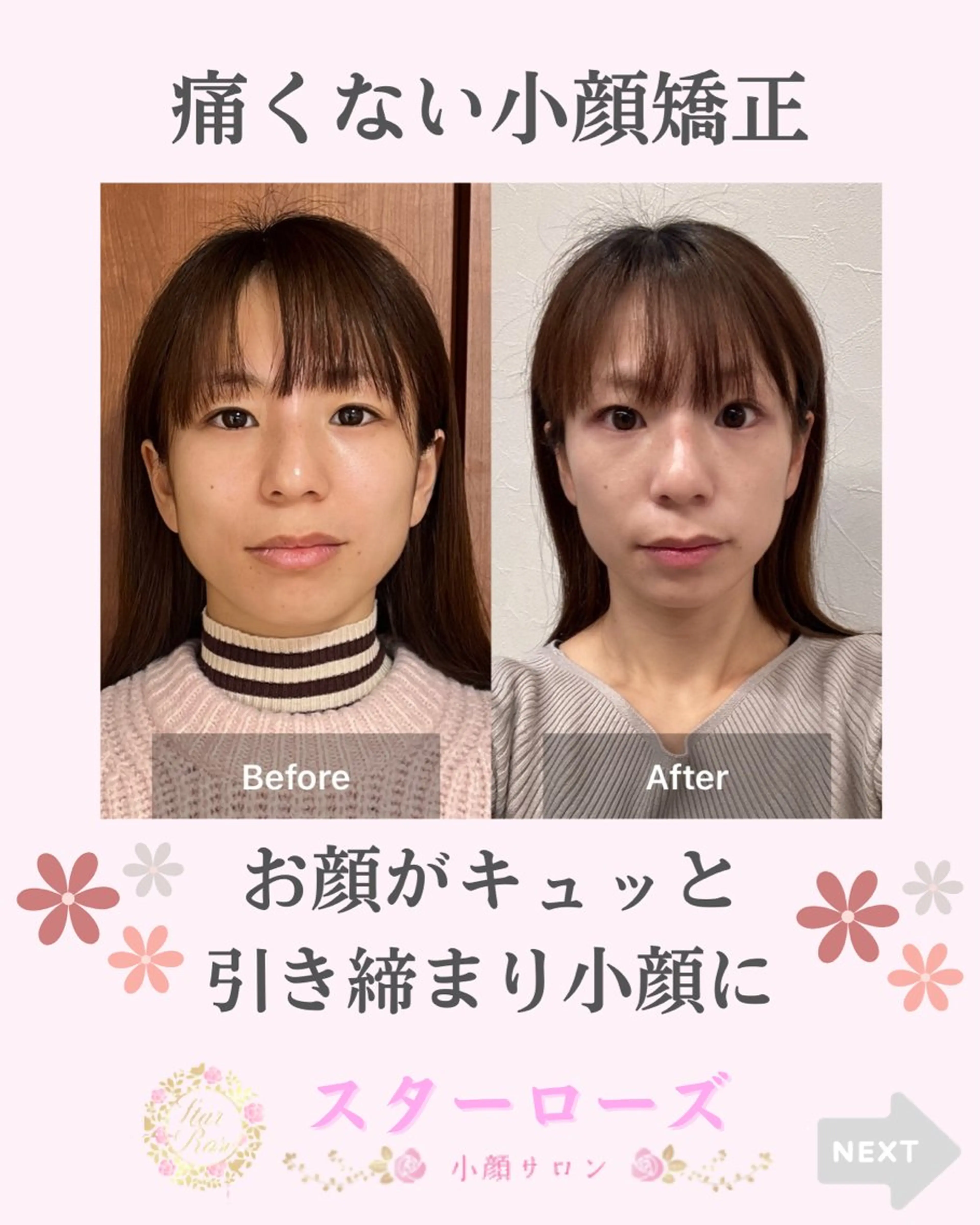 スターローズ所属・小顔矯正サロン スターローズのエステ・リラクイメージ