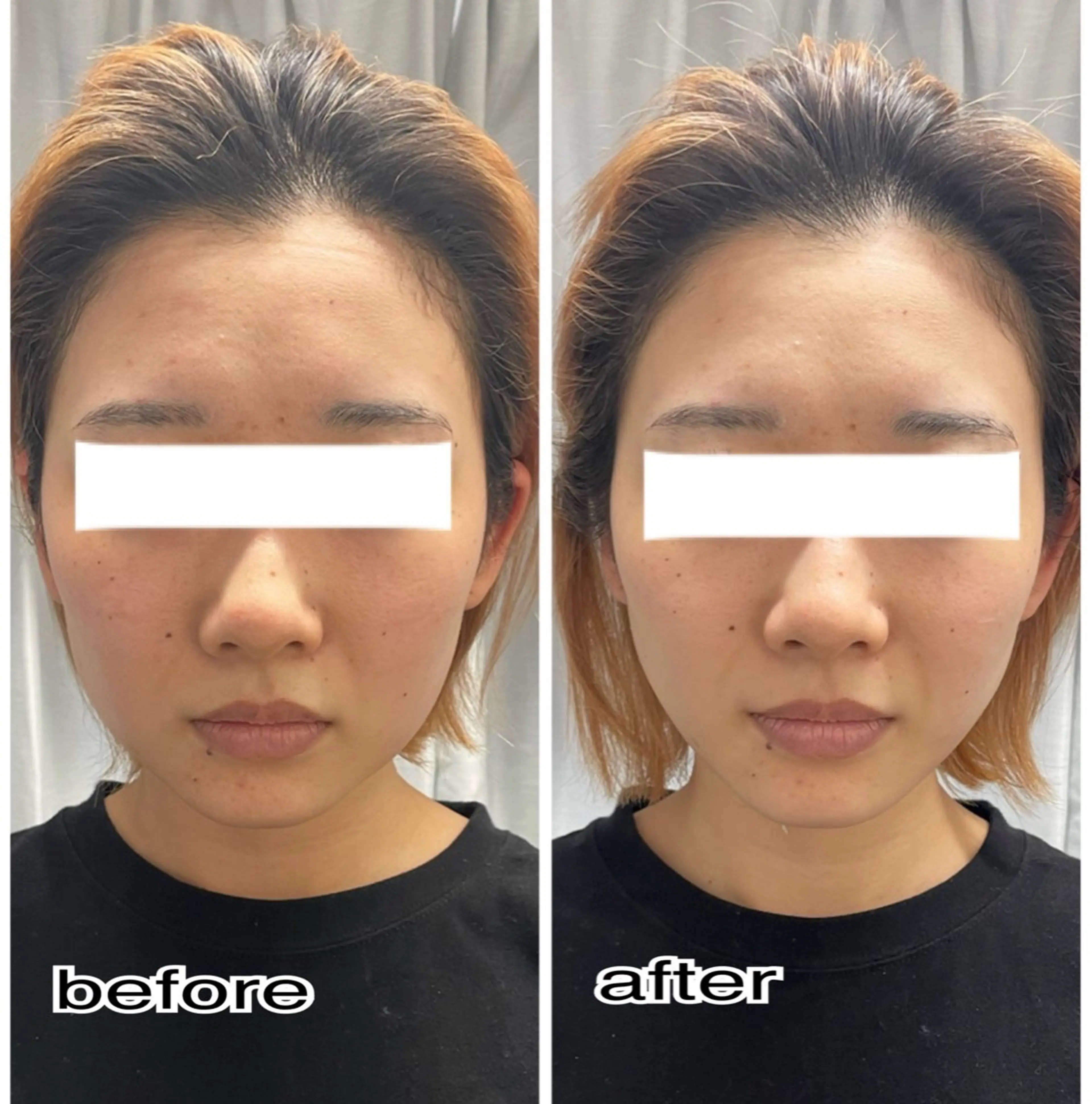 その他 ENCHANT 脱毛.小顔.毛穴のエステ・リラクイメージ