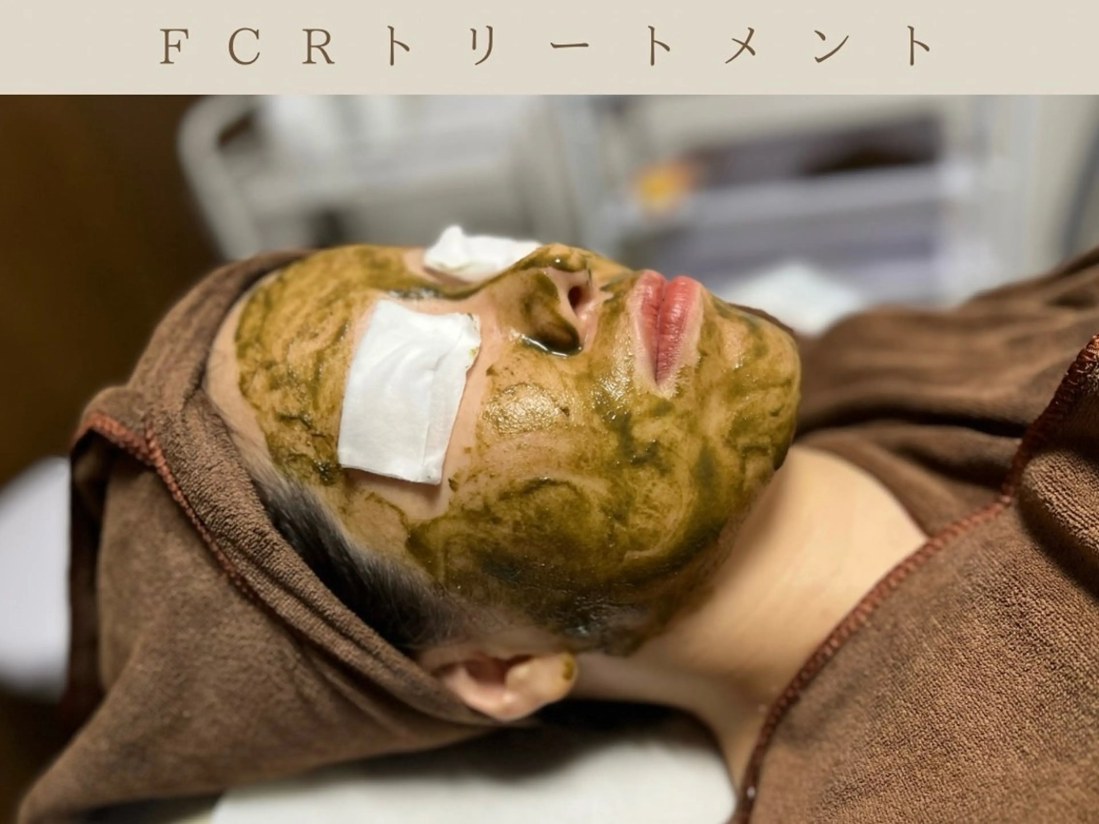 【ニキビ/ニキビ跡/毛穴/肌質改善】FCRハーブピーリング(剥離あり) プラセンタジェルホームケア付きの写真