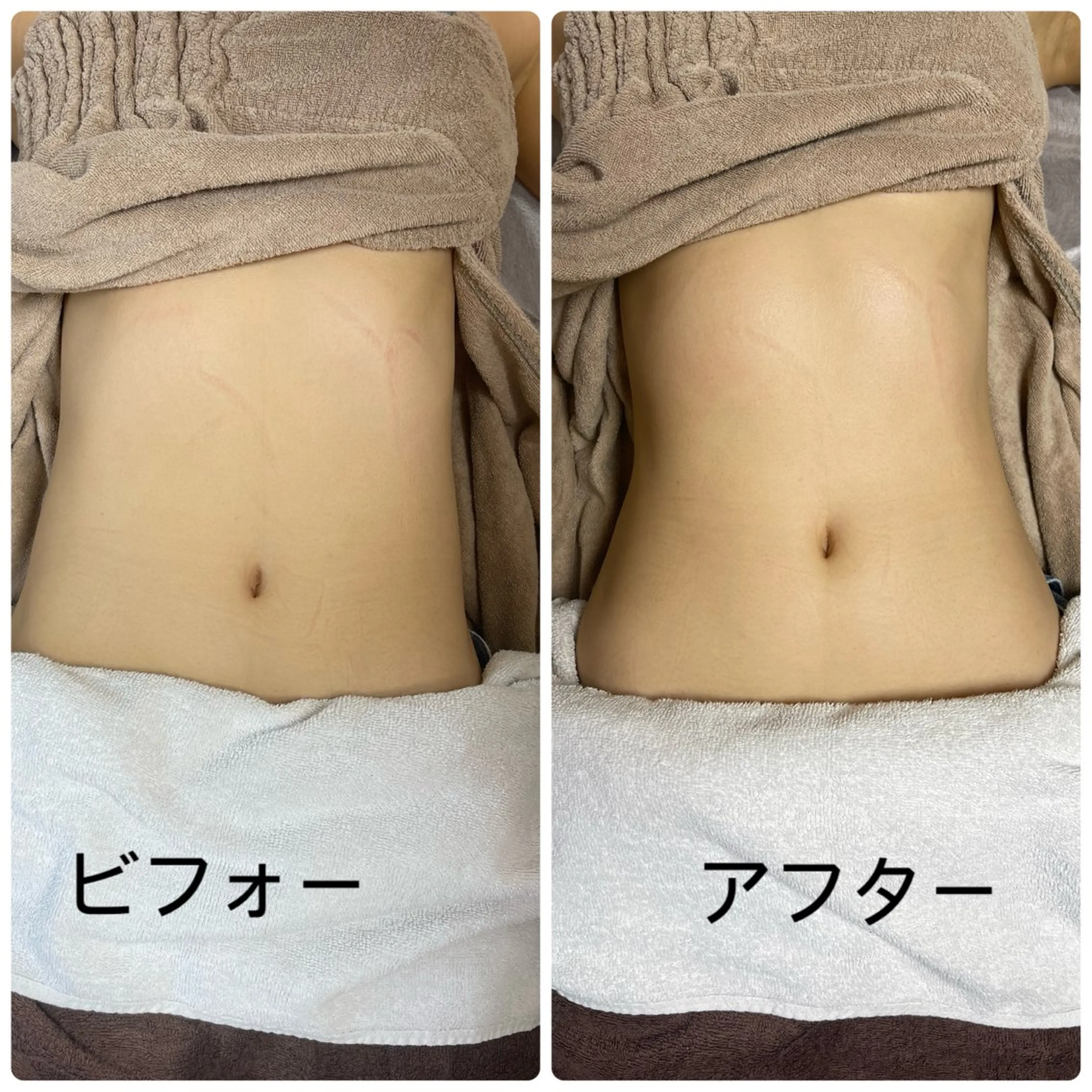 遺伝子ケアの写真