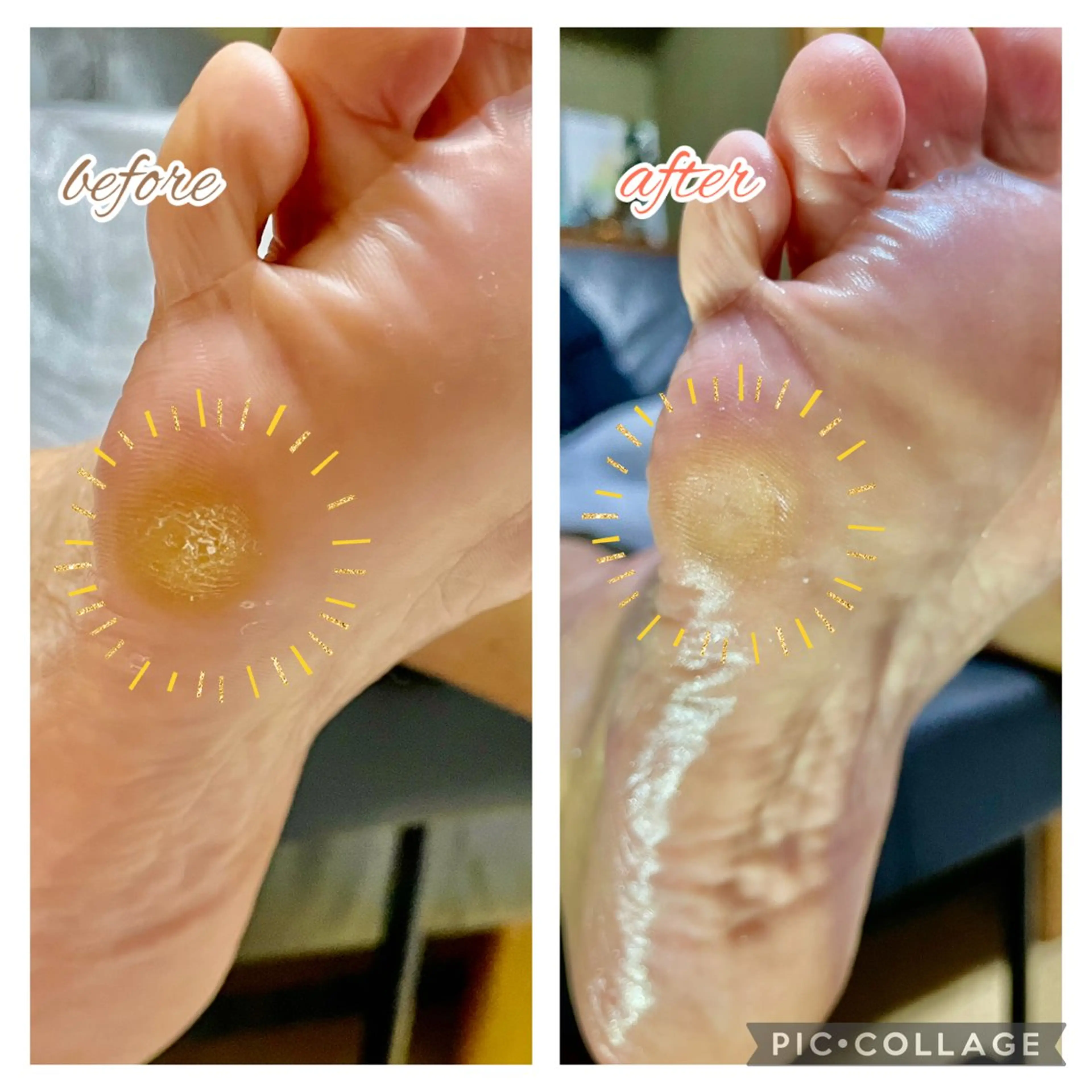 タコのケアの写真