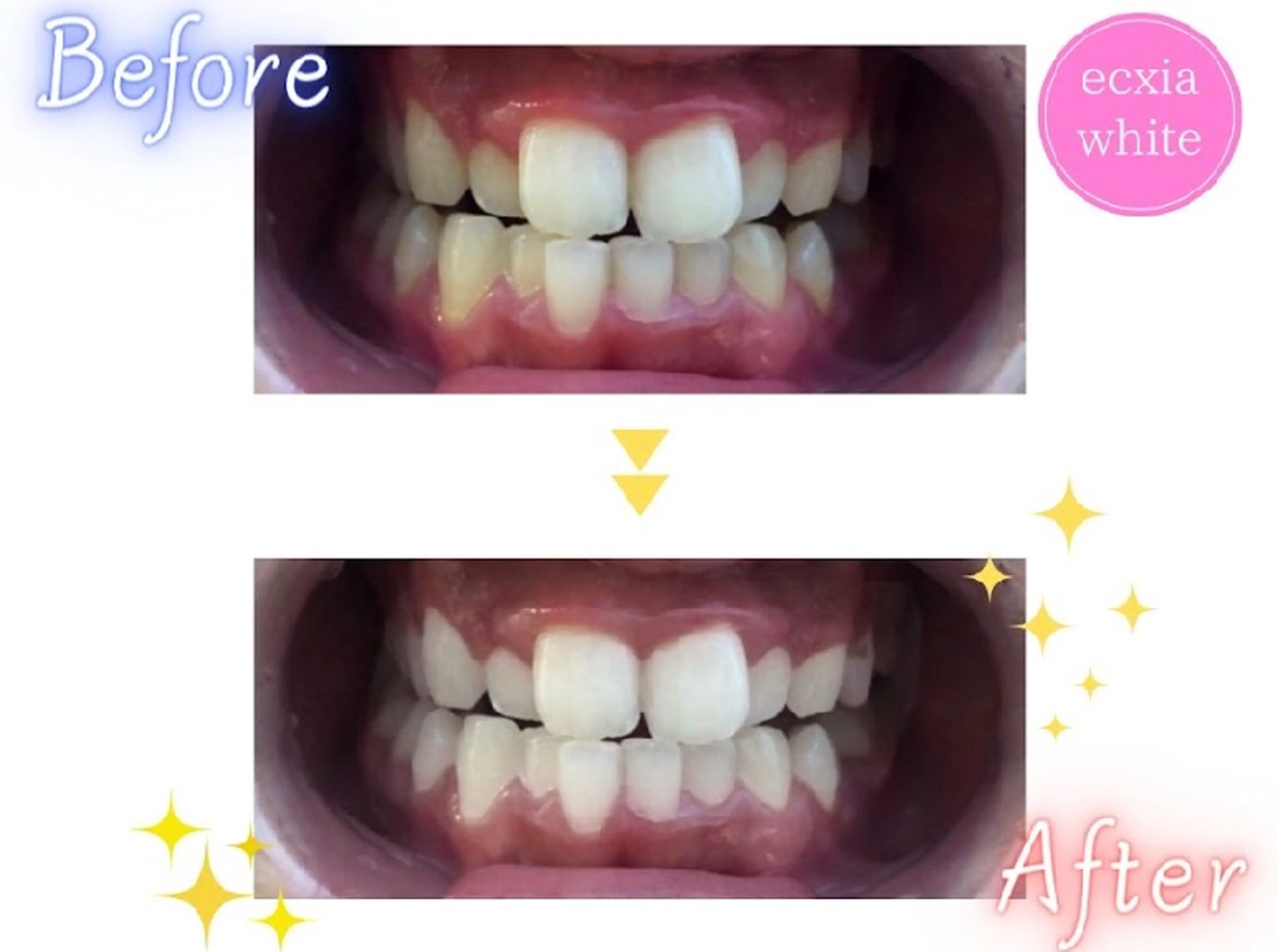 メンズ その他 エクシアホワイトニング草津店所属・nanami -ホワイトニングのその他イメージ