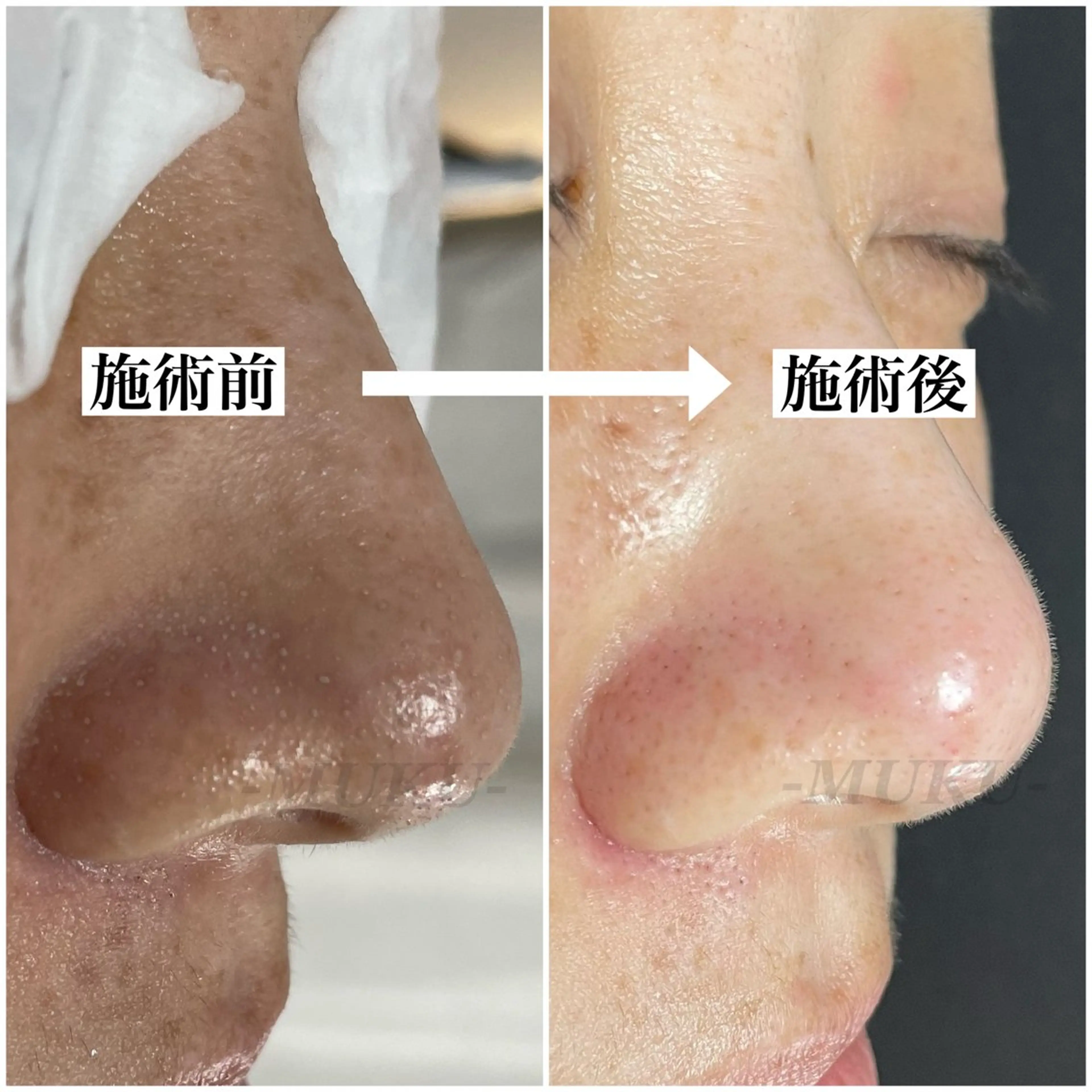 MUKU所属・毛穴専門サロン MUKUムクのエステ・リラクイメージ