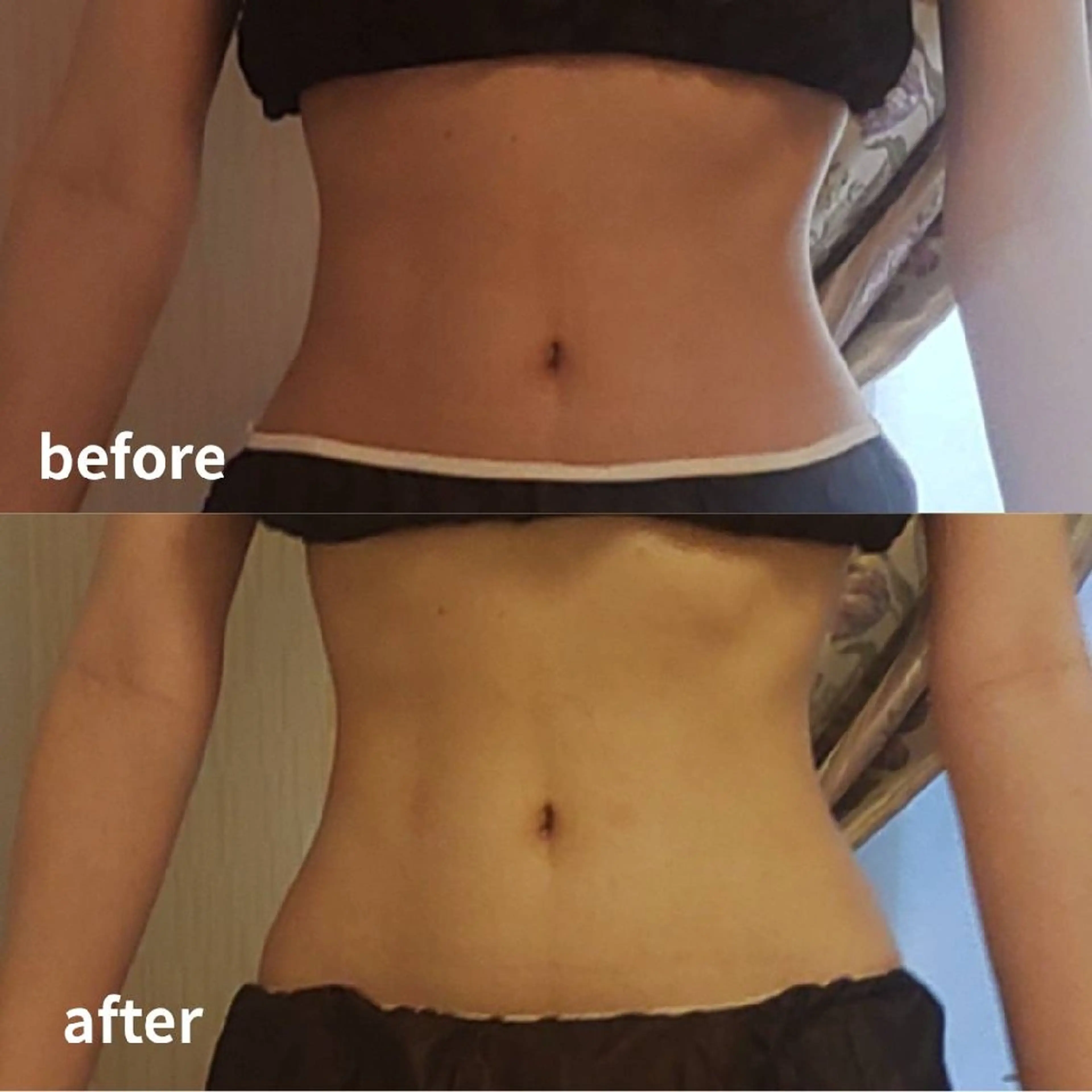 エステ リラク 痩身小顔専門 アマテ ビューティー.Nのエステ・リラクイメージ