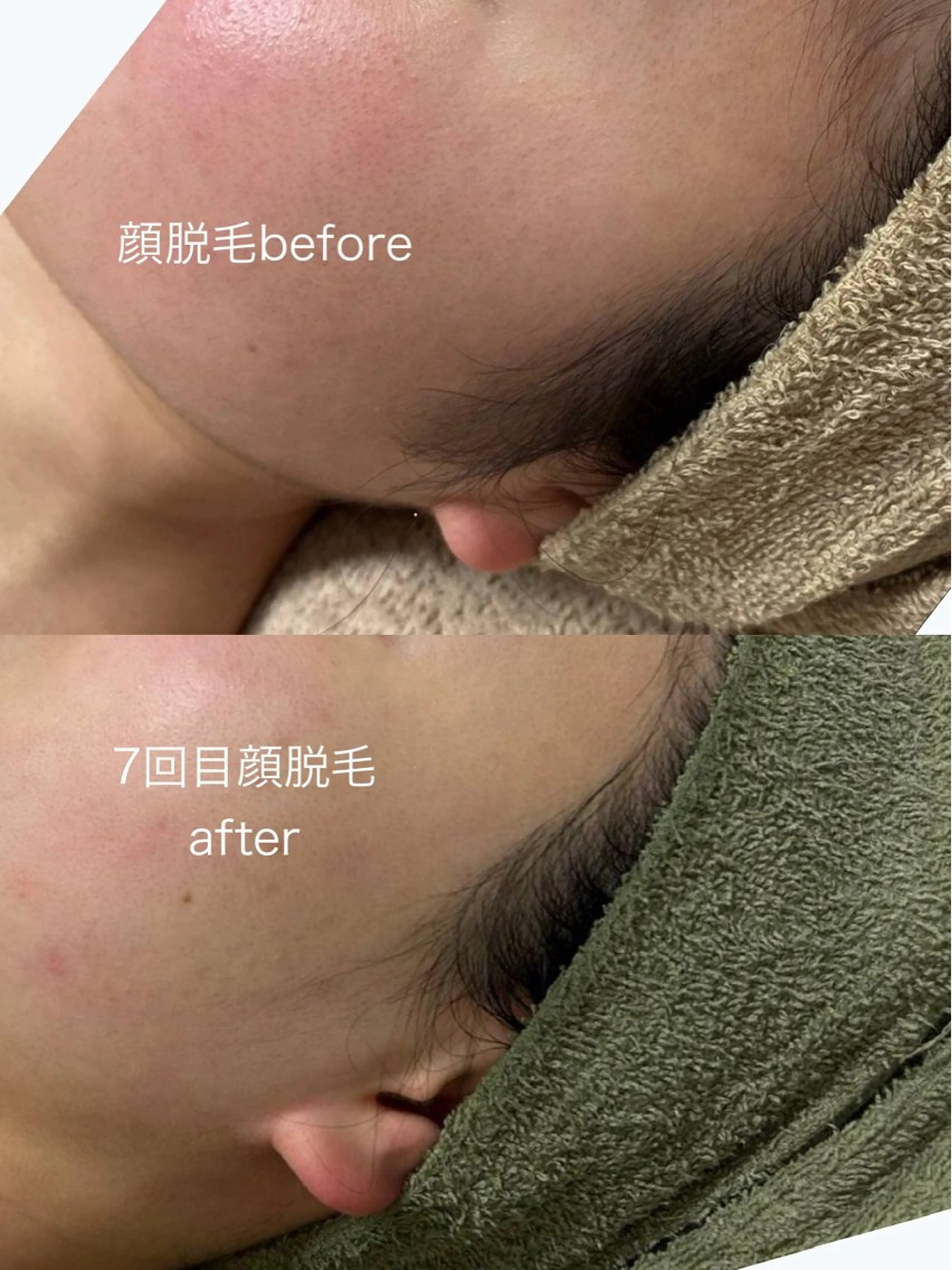 脱毛 salon de jessicaのエステ・リラクイメージ