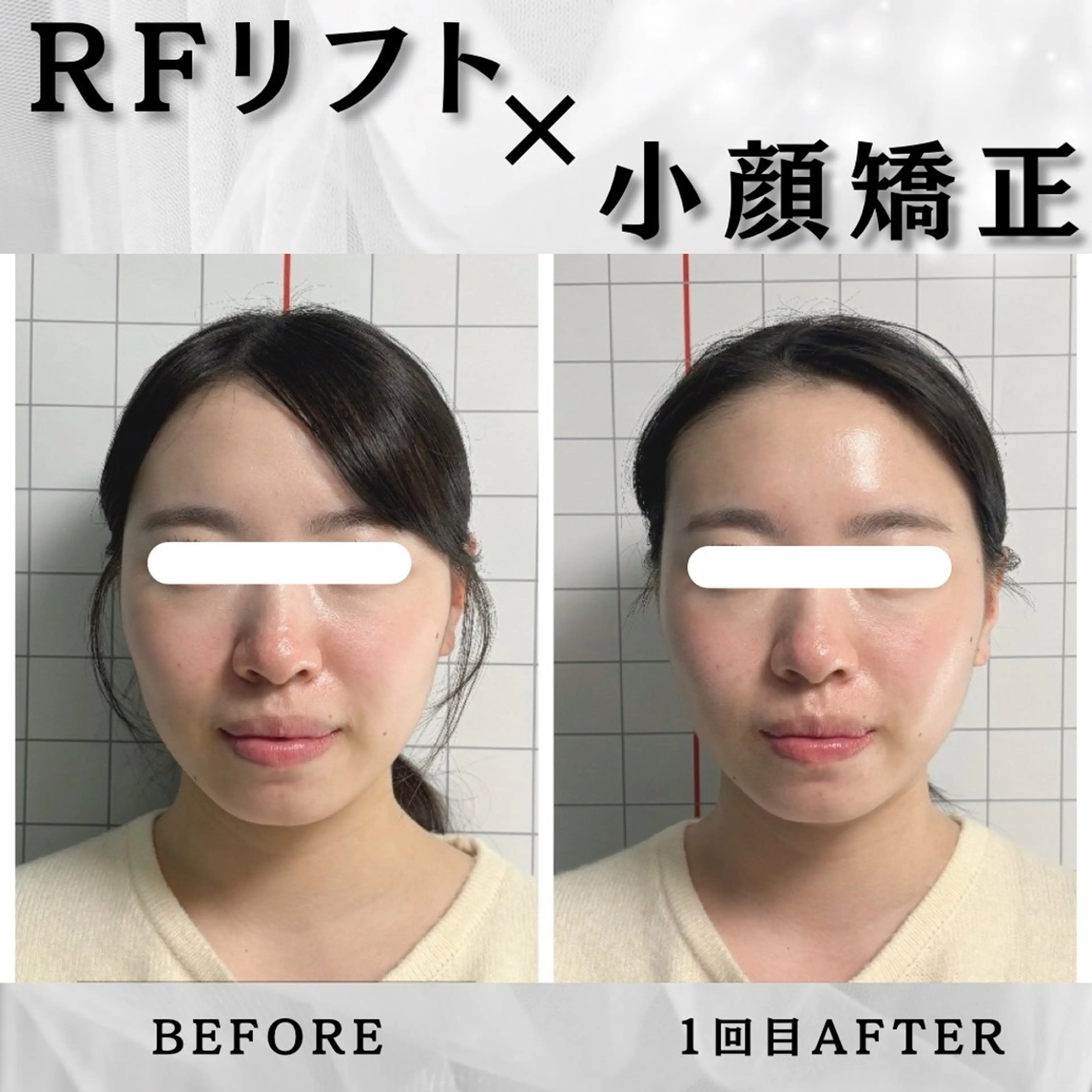 エステ リラク 小顔矯正専門店 【RED】池田のエステ・リラクイメージ