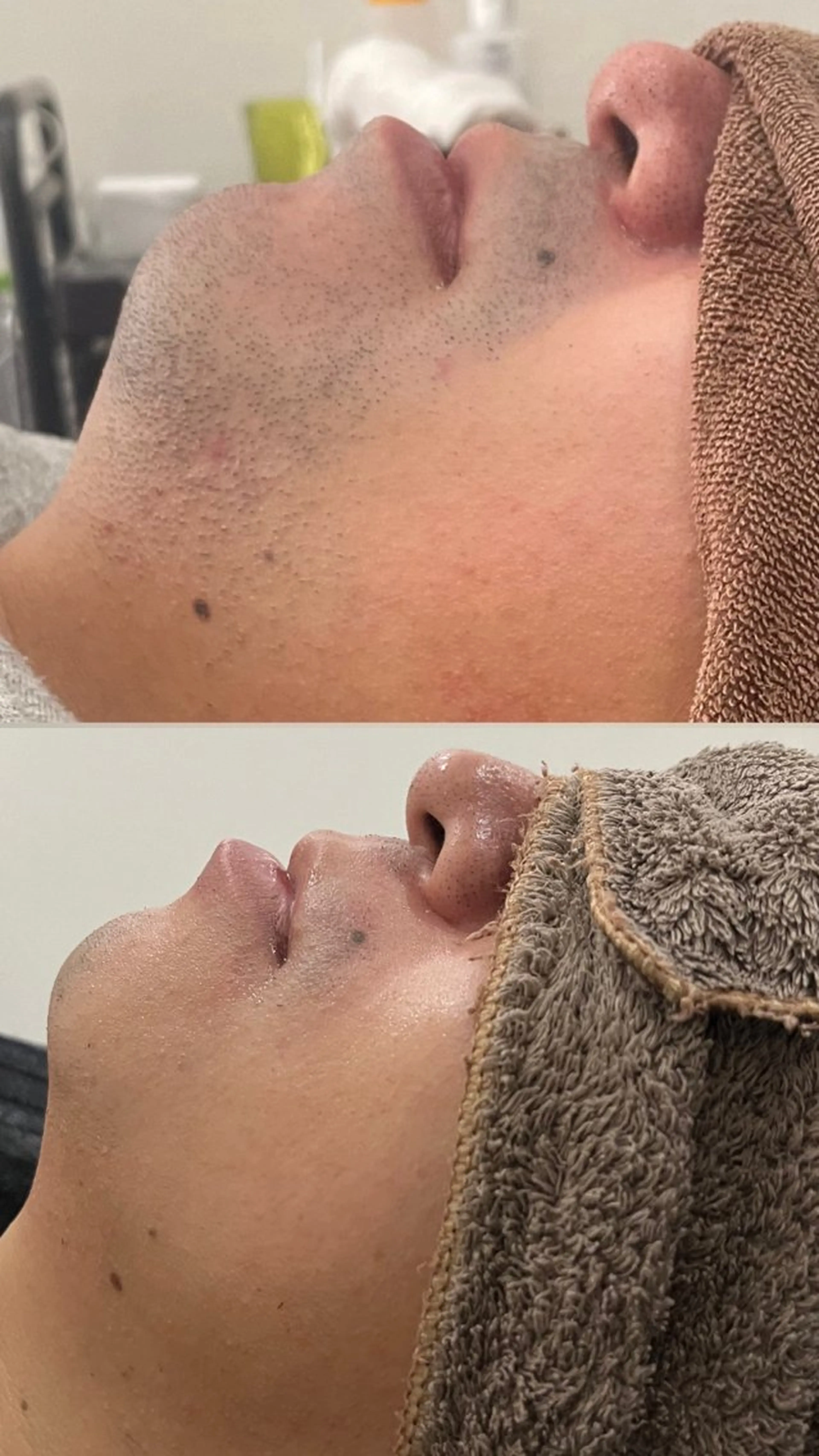 メンズ Folche三川町ア ピールポイント確認！のエステ・リラクイメージ