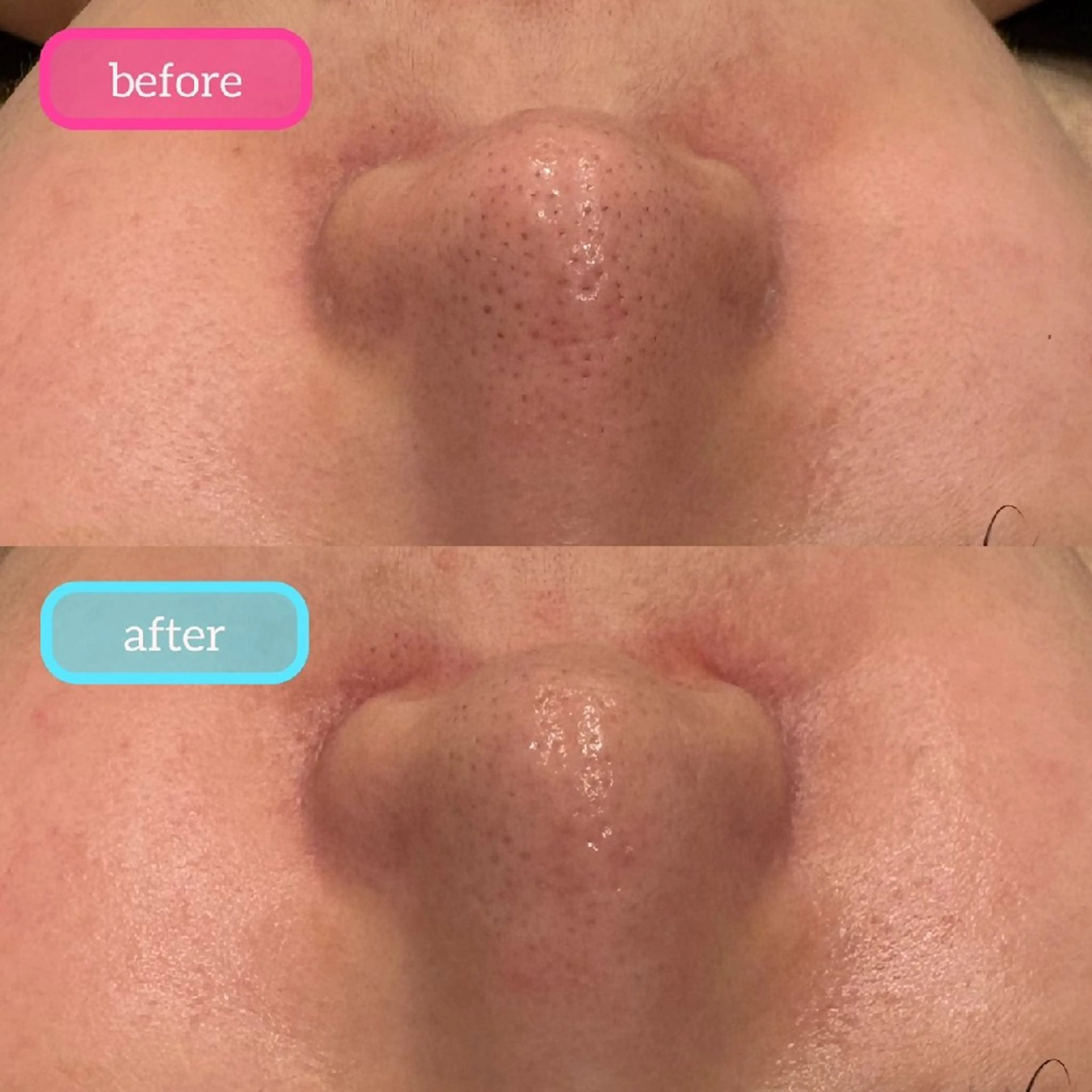 エステ ベル チェリカ 三城のエステ・リラクイメージ