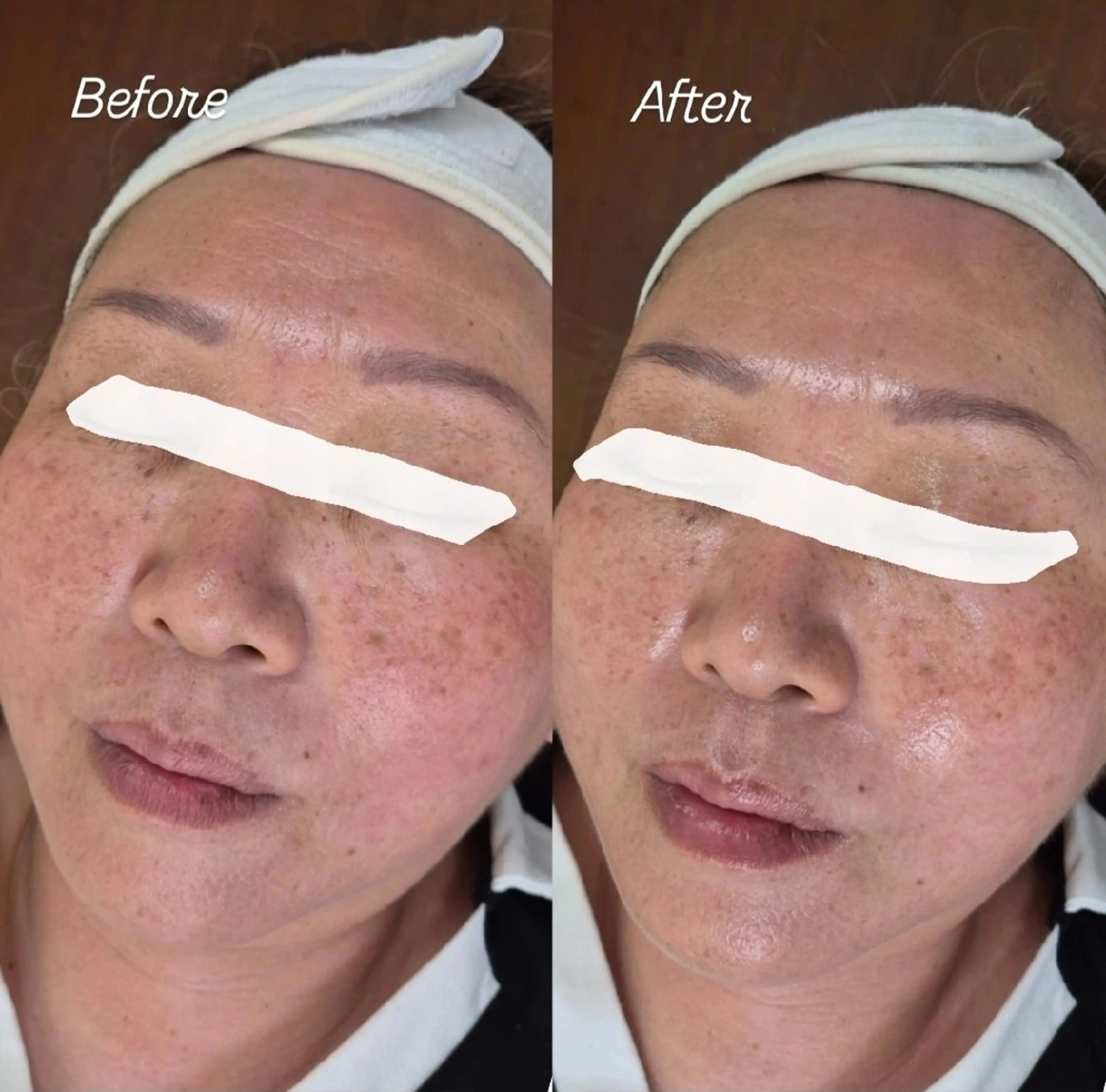 エステ FERNABELL所属・岩本 ひなののエステ・リラクイメージ