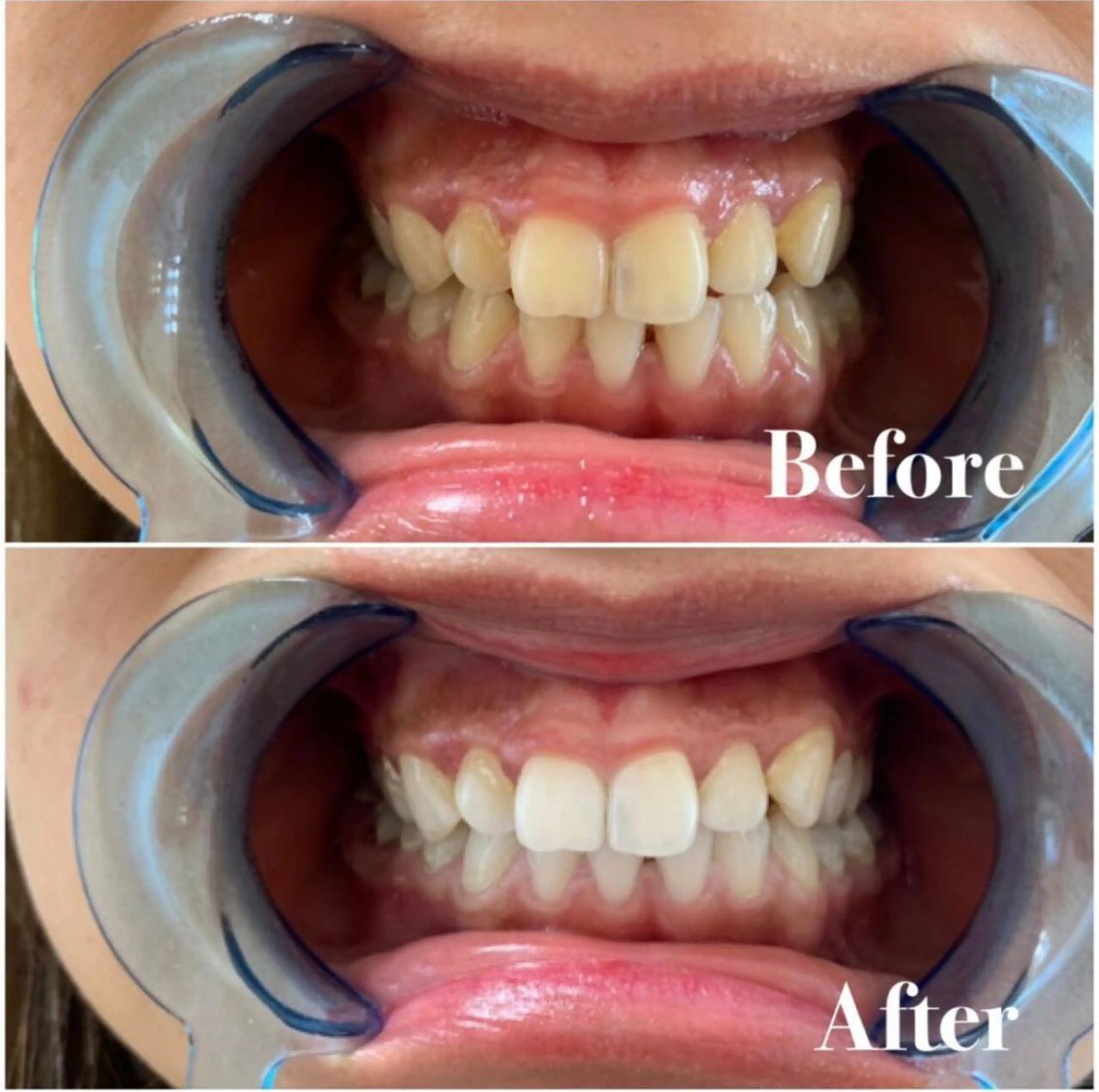 その他 ライトビューティー 恵比寿店のその他イメージ