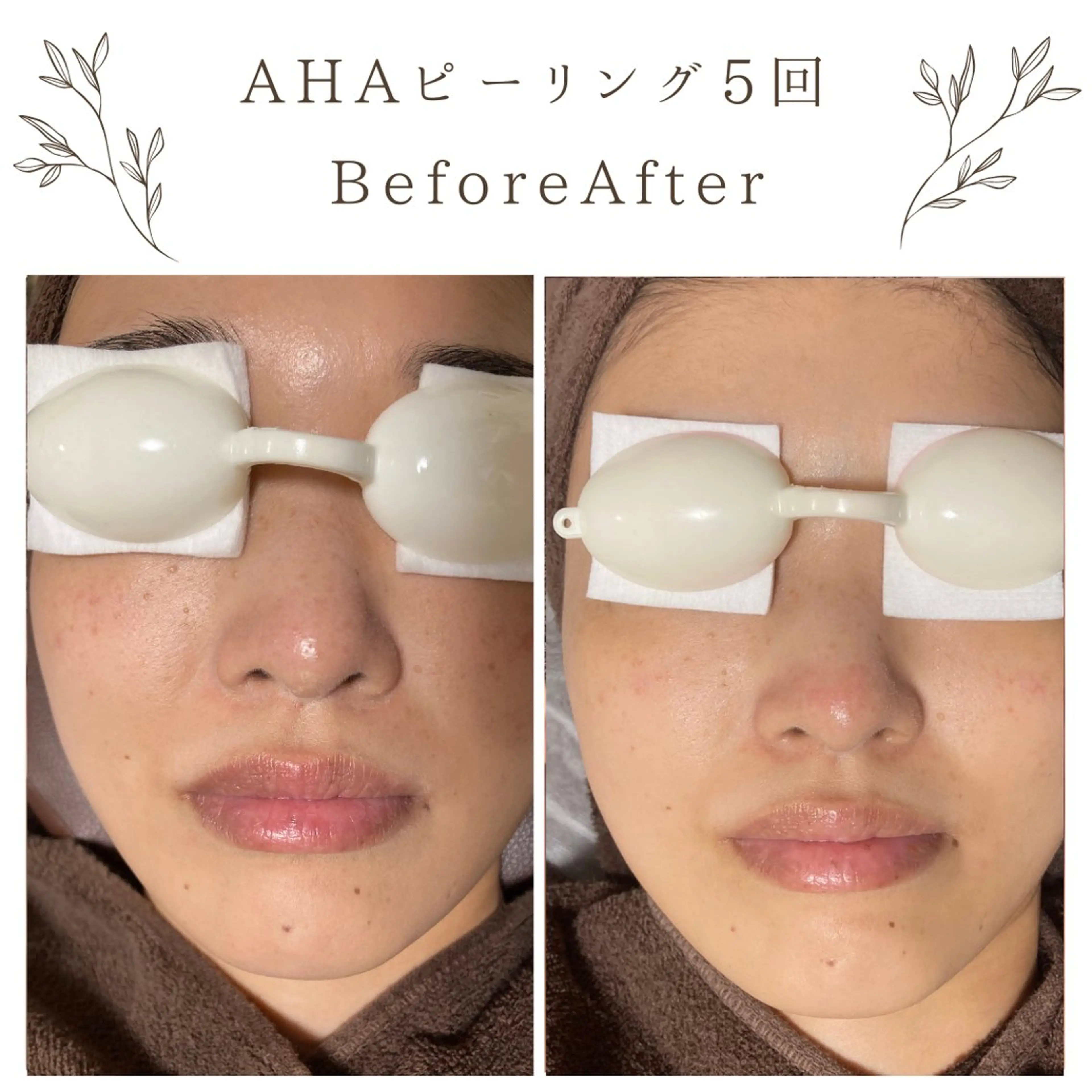 な ぎのエステ・リラクイメージ