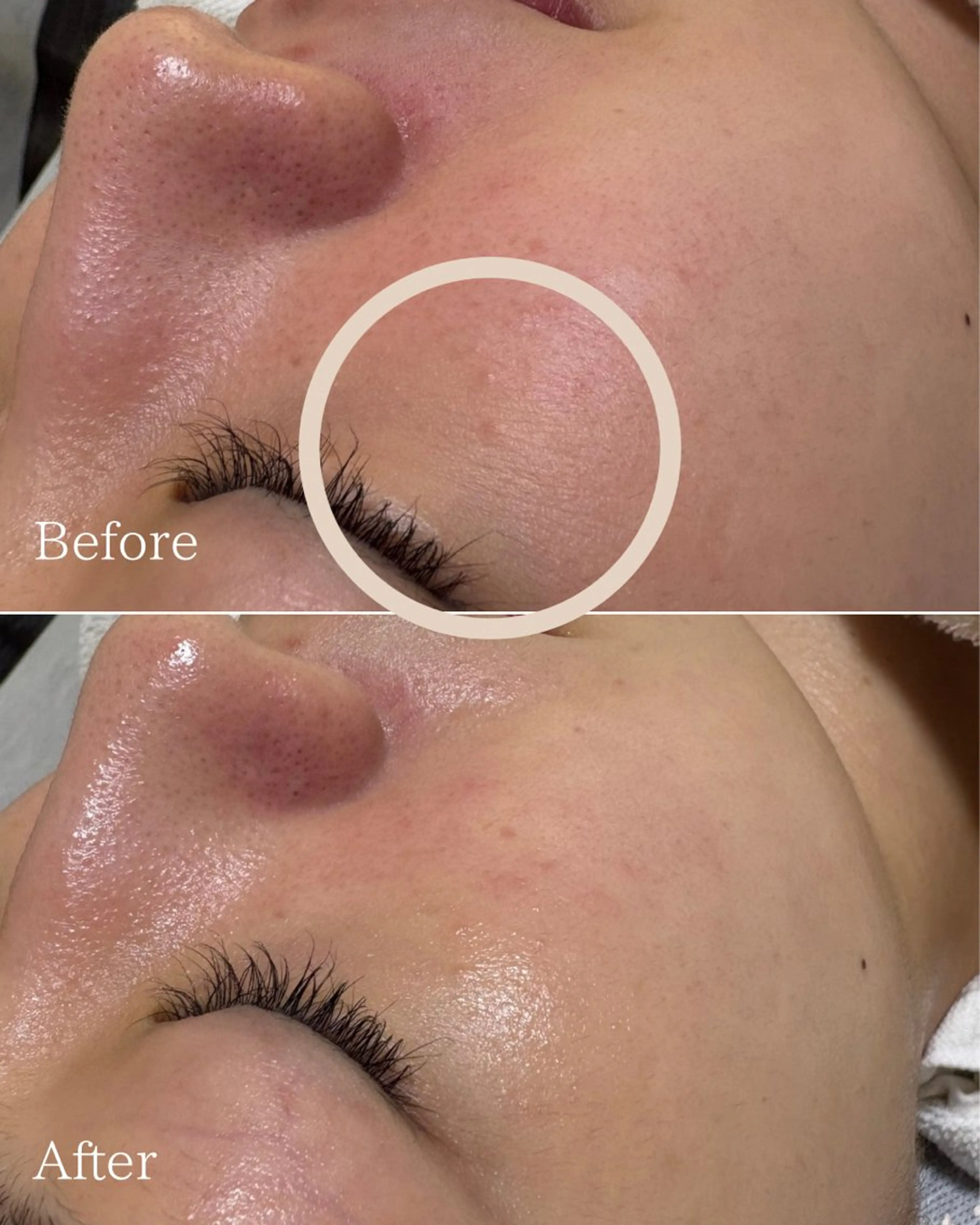 エステと焼き菓子 レモンバームソワンのエステ・リラクイメージ