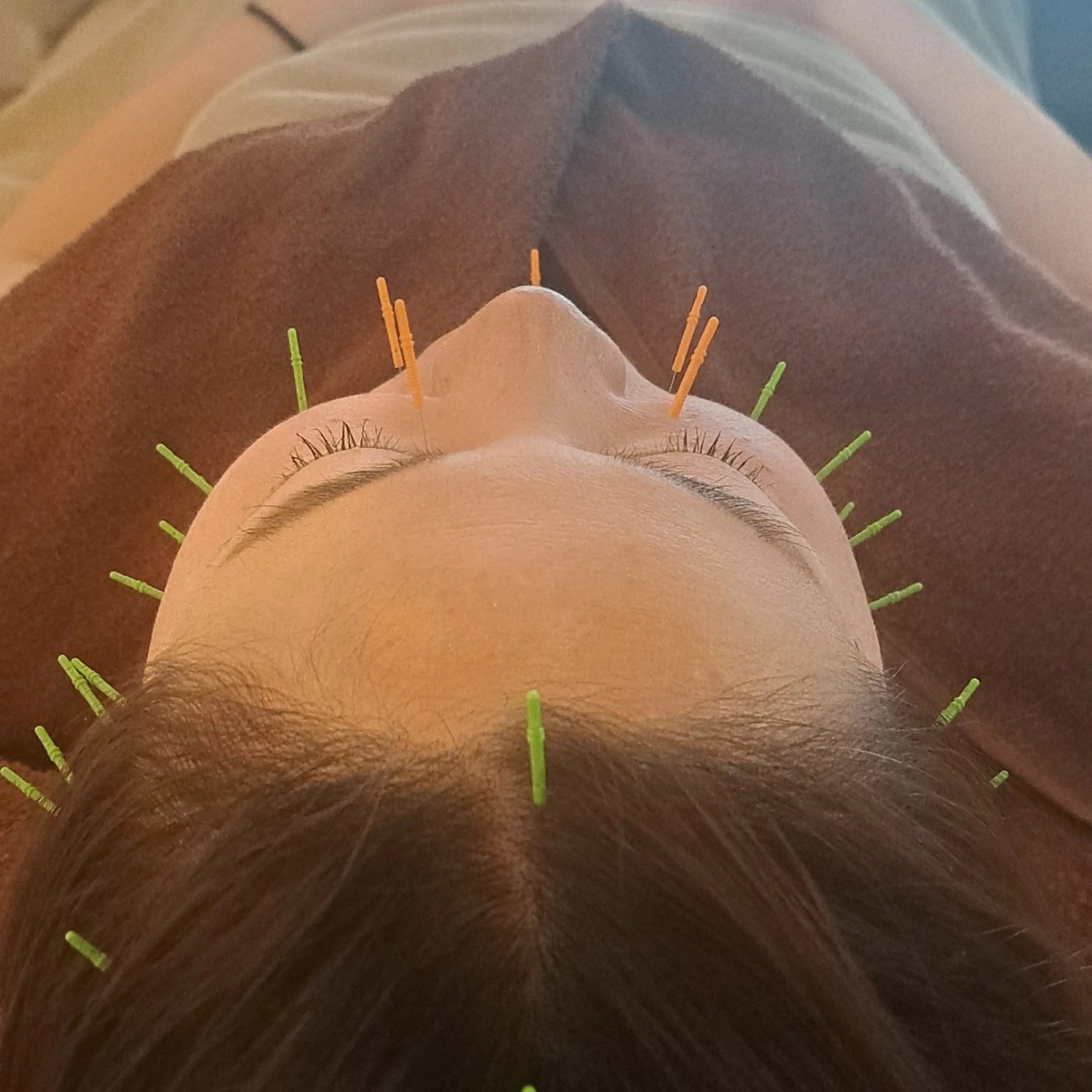 エステ リラク 鍼灸サロンmiyabi所属・美容鍼×エステ 鍼灸 サロンmiyabiのエステ・リラクイメージ