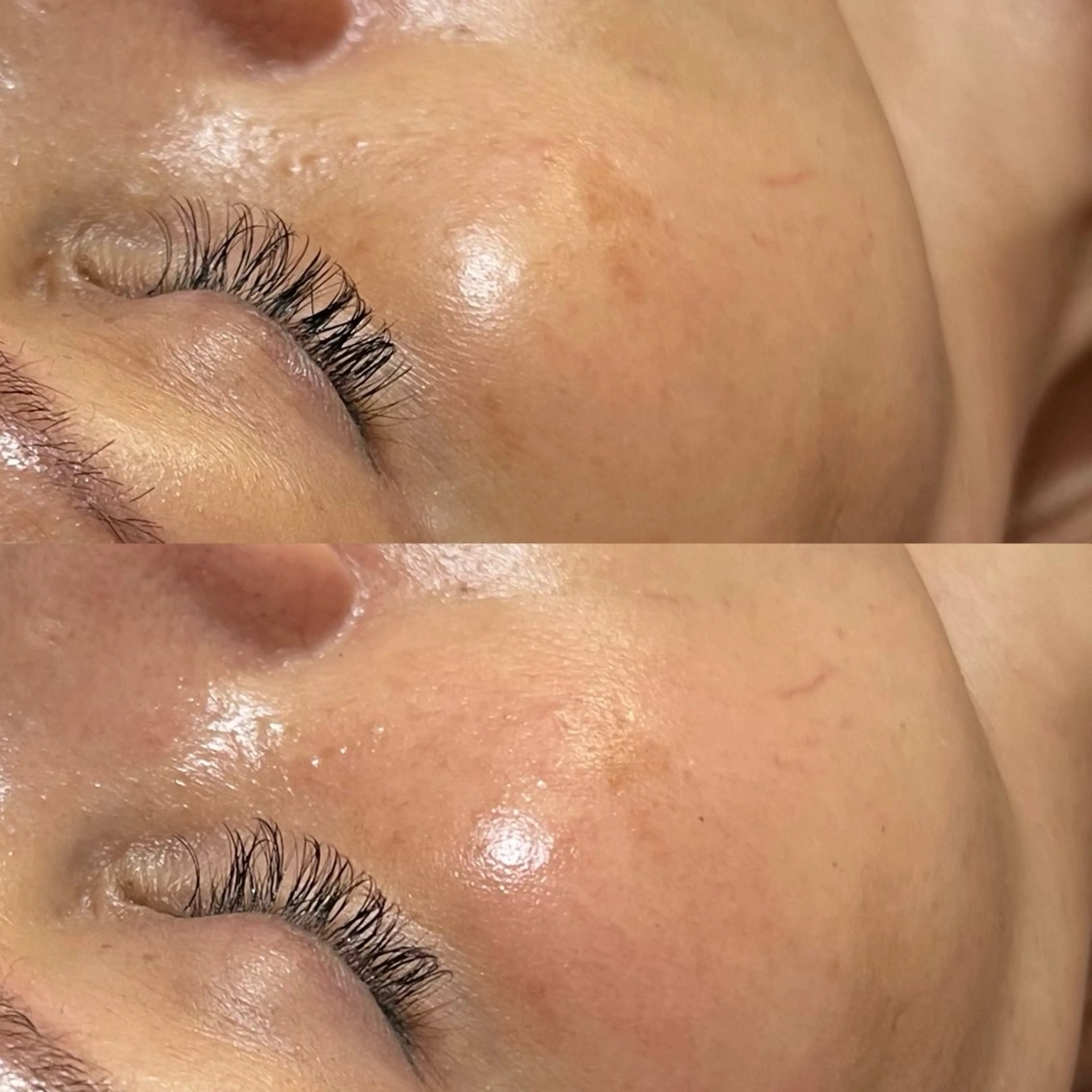 エステ 𝐌𝐚𝐜𝐡𝐞 𝐛𝐲 𝐌𝐚𝐲𝐮所属・ハーブピーリング🌿 𝑴𝒂𝒚𝒖のエステ・リラクイメージ